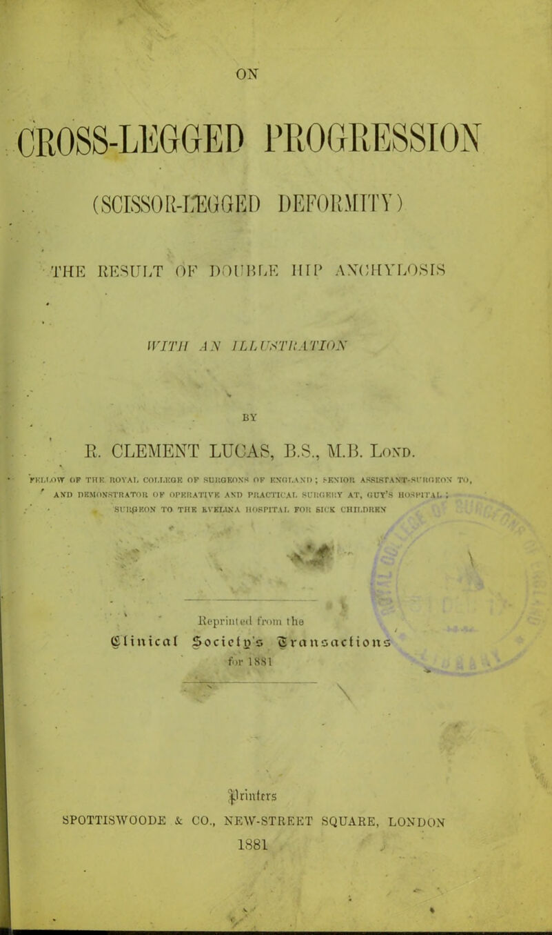 ON CROSS-LUGGED PROGRESSION (SOKSOE-IXaOED DEFORMITY) THE RESULT OF DOUBLE HIP ANCHYLOSIS WITH A N 1L L HATHA TION BY R. CLEMENT LUCAS, B.S, M.B. Bond. fellow (if thk, rtovAi, college of suugeoxs of kxglaxd; f-Kxion assist a xt-s i ■ ho kox to, axo demonstrator of operative and practical surgery at, guy’s hospital ; , SUIipKON TO THE EVELINA HOSPITAL for bice CHILDREN' \ lteprinled from the Clinical Society's transactions for 1881 \ * printers SPOTTISWOODE & CO., NEW-STREKT SQUARE, LONDON 1881 * / \