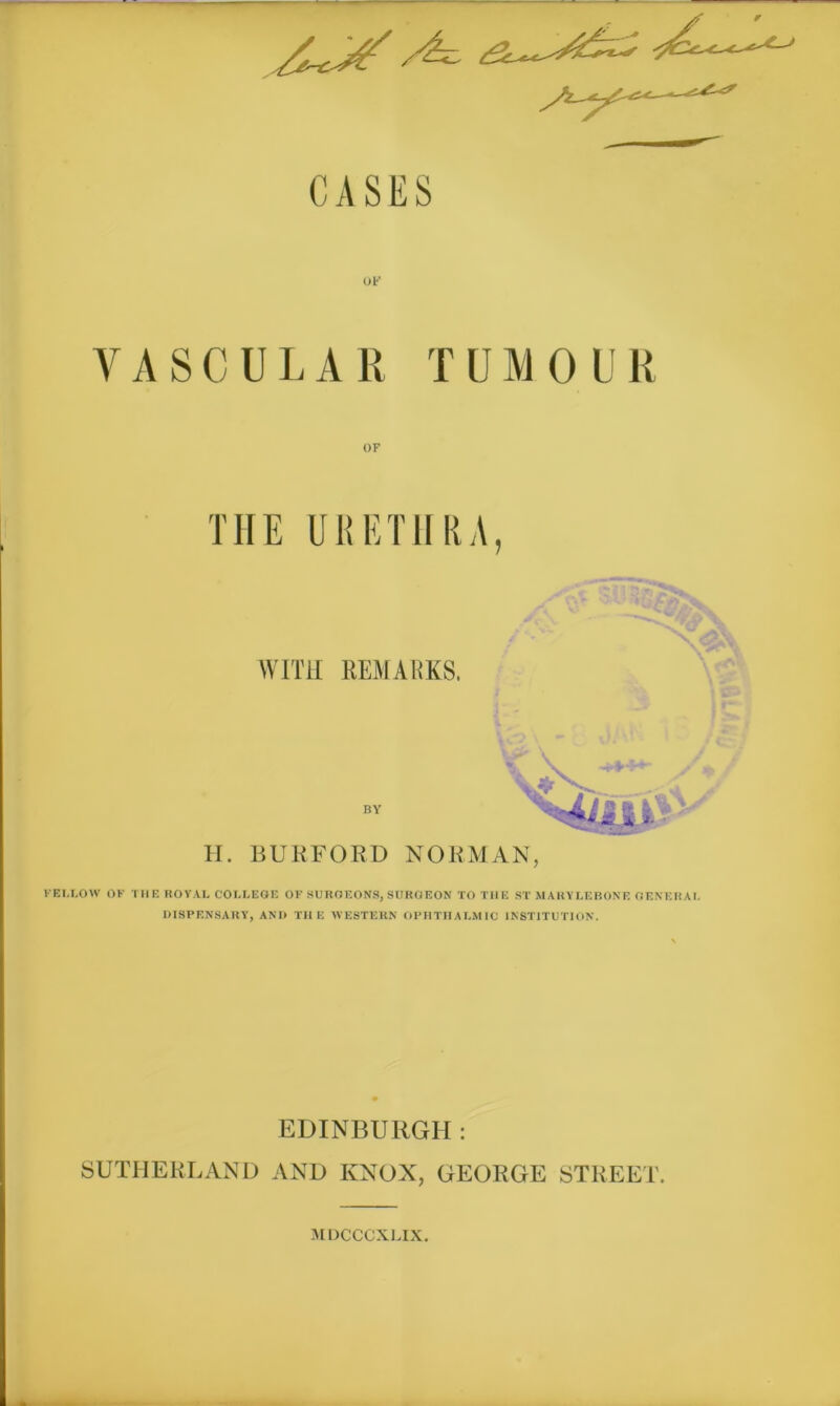 CASES OF VASCULAR TUMOUR OF THE URETHRA, WITH REMARKS. \ t*' \\ H. BURFORD NORMAN, FELLOW OF THE ROYAL COLLEGE OF SURGEONS, SURGEON TO THE ST MAKYLEBONE GENERAL DISPENSARY, AND THE WESTERN OPHTHALMIC INSTITUTION. EDINBURGH: SUTHERLAND AND KNOX, GEORGE STREET. MDCCCXLIX.