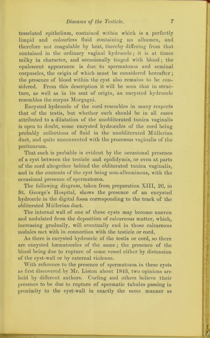 tesselated epithelium, contained within which is a perfectly limpid and colourless fluid containing no albumen, and therefore not coagulable by heat, thereby differing from that contained in the ordinary vaginal hydrocele; it is at times milky in character, and occasionally tinged with blood ; the opalescent appearance is due to spermatozoa and seminal corpuscles, the origin of which must be considered hereafter; the presence of blood within the cyst also remains to be con- sidered. From this description it will be seen that in struc- ture, as well as in its seat of origin, an encysted hydrocele resembles the corpus Morgagni. Encysted hydrocele of the cord resembles in many respects that of the testis, but whether such should be in all cases attributed to a dilatation of the unobliterated tunica vaginalis is open to doubt, some encysted hydroceles of the cord being probably collections of fluid in the unobliterated Mullerian duct, and quite unconnected with the processus vaginalis of the peritoneum. That such is probable is evident by the occasional presence of a cyst between the testicle and epididymis, or even at parts of the cord altogether behind the obliterated tunica vaginalis, and in the contents of the cyst being non-albuminous, with the occasional presence of spermatozoa. The following diagram, taken from preparation XIII, 26, in St. George’s Hospital, shows the presence of an encysted hydrocele in the digital fossa corresponding to the track of the obliterated Mullerian duct. The internal wall of one of these cysts may become uneven and nodulated from the deposition of calcareous matter, which, increasing gradually, will eventually end in those calcareous nodules met with in connection with the testicle or cord. As there is encysted hydrocele of the testis or cord, so there are encysted haematoceles of the same ; the presence of the blood being due to rupture of some vessel either b}r distension of the cyst-wall or by external violence. With reference to the presence of spermatozoa in these cysts as first discovered by Mr. Liston about 1813, two opinions are held by different authors. Curling and others believe their presence to be due to rupture of spermatic tubules passing in proximity to the cyst-wall in exactly the same manner as