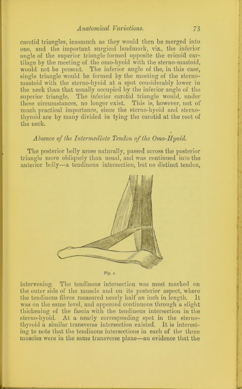 carotid triangles, inasmuch as they would then be merged into one, and the important surgical landmark, viz., the inferior angle of the superior triangle formed opposite the cricoid car- tilage by the meeting of the omo-hyoid with the sterno-mastoid, would not be present. The inferior angle of the, in this case, single triangle would be formed by the meeting of the sterno- mastoid with the sterno-hyoid at a spot considerably lower in the neck than that usually occupied by the inferior angle of the superior triangle. The inferior carotid triangle would, under these circumstances, no longer exist. This is, however, not of much practical importance, since the sterno-hyoid and sterno- thyroid are by many divided in tying the carotid at the root of the neck. Absence of the Intermediate Tendon of the Omo-Hyoid. The posterior belly arose naturally, passed across the posterior triangle more obliquely than usual, and was continued into the anterior belly—a tendinous intersection, but no distinct tendon, Pig. 2. intervening. The tendinous intersection was most marked on the outer side of the muscle and on its posterior aspect, where the tendinous fibres measured nearly half an inch in length. It was on the same level, and appeared continuous through a slight thickening of the fascia with the tendinous intersection in the sterno-hyoid. At a nearly corresponding spot in the sterno- thyroid a similar transverse intersection existed. It is interest- ing to note that the tendinous intersections in each of the three muscles were in the same transverse plane—an evidence that the