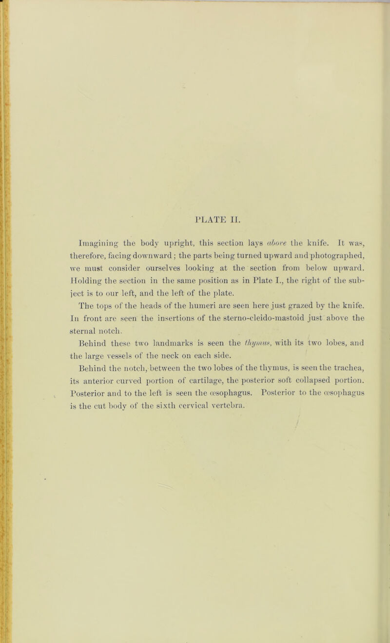 Imagining the body upright, this section lays above the knife. It was, therefore, facing downward ; the parts being turned upward and photographed, we must consider ourselves looking at the section from below upward. Holding the section in the same position as in Plate I., the right of the sub- iect is to our left, and the left of the plate. The tops of the heads of the humeri are seen here just grazed by the knife. In front are seen the insertions of the sterno-cleido-mastoid just above the sternal notch. Behind these two landmarks is seen the thymus, with its two lobes, and the large vessels of the neck on each side. Behind the notch, between the two lobes of the thymus, is seen the trachea, its anterior curved portion of cartilage, the posterior soft collapsed portion. Posterior and to the left is seen the oesophagus. Posterior to the oesophagus is the cut body of the sixth cervical vertebra.