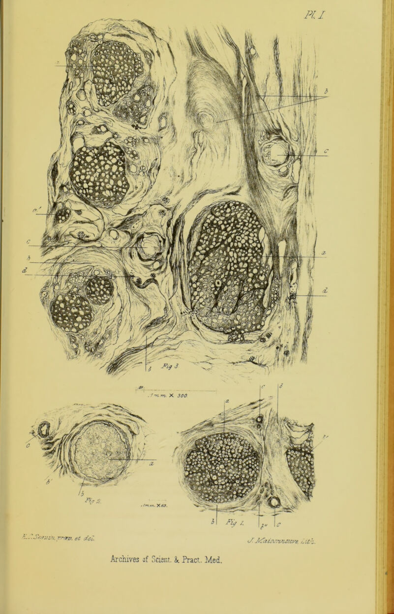 PI. I %..'SMxm.Tr&p. et del </. JfaiMvzaeyg, Archives of Scisnt. & Pract. Med.