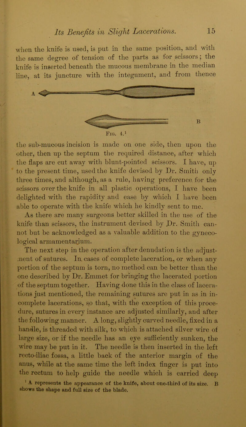 when the knife is used, is put in the same position, and with the same degree of tension of the parts as tor scissors; the knife is inserted beneath the mucous membrane in the median line, at its juncture with the integument, and from thence the sub-mucous incision is made on one side, then upon the other, then up the septum the required distance, after which the flaps are cut away with blunt-pointed scissors. I have, up to the present time, used the knife devised by Dr. Smith only three times, and although, as a rule, having preference for the scissors over the knife in all plastic operations, I have been delighted with the rapidity and ease by which I have been able to operate with the knife which he kindly sent to me. As there are many surgeons better skilled in the use of the knife than scissors, the instrument devised by Dr. Smith can- not but be acknowledged as a valuable addition to the gyneco- logical armamentarium. The next step in the operation after denudation is the adjust- ment of sutures. In cases of complete laceration, or when any portion of the septum is torn, no method can be better than the one described by Dr. Emmet for bringing the lacerated portion of the septum together. Having done this in the class of lacera- tions just mentioned, the remaining sutures are put in as in in- complete lacerations, so that, with the exception of this proce- dure, sutures in every instance are adjusted similarly, and after the following manner. A long, slightly curved needle, fixed in a handle, is threaded with silk, to which is attached silver wire of large size, or if the needle has an eye sufficiently sunken, the wire may be put in it. The needle is then inserted in the left recto-iliac fossa, a little back of the anterior margin of the anus, while at the same time the left index finger is put into the rectum to help guide the needle which is carried deep 1 A represents the appearance of the knife, about one-third of its size. B shows the shape and full size of the blade.