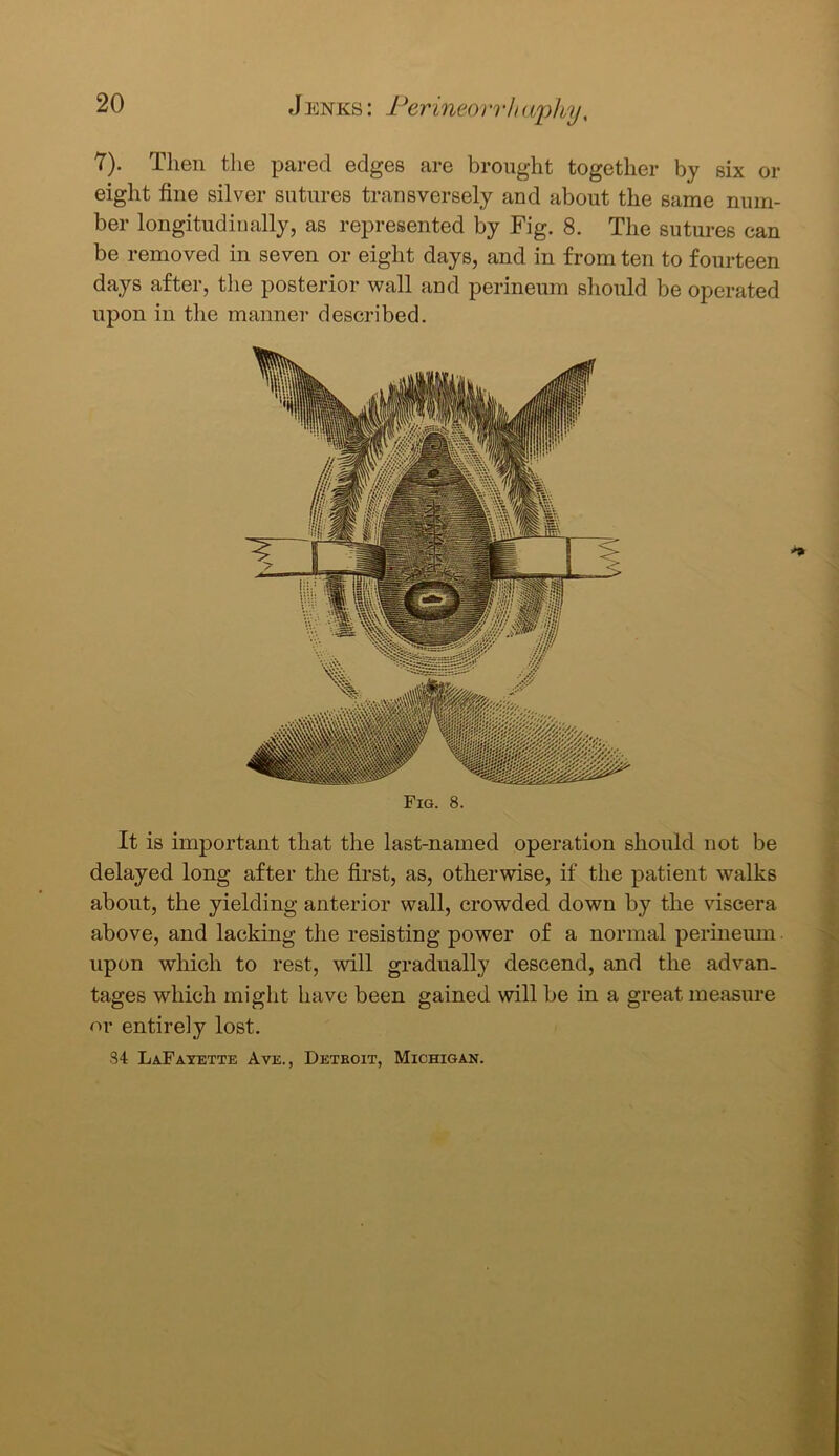 7). Then the pared edges are brought together by six or eight fine silver sutures transversely and about the same num- ber longitudinally, as represented by Fig. 8. The sutures can be removed in seven or eight days, and in from ten to fourteen days after, the posterior wall and perineum should be operated upon in the manner described. Fig. 8. It is important that the last-named operation should not be delayed long after the first, as, otherwise, if the patient walks about, the yielding anterior wall, crowded down by the viscera above, and lacking the resisting power of a normal perineum upon which to rest, will gradually descend, and the advan- tages which might have been gained will be in a great measure or entirely lost. 84 LaFayette Ave., Detboit, Michigan.