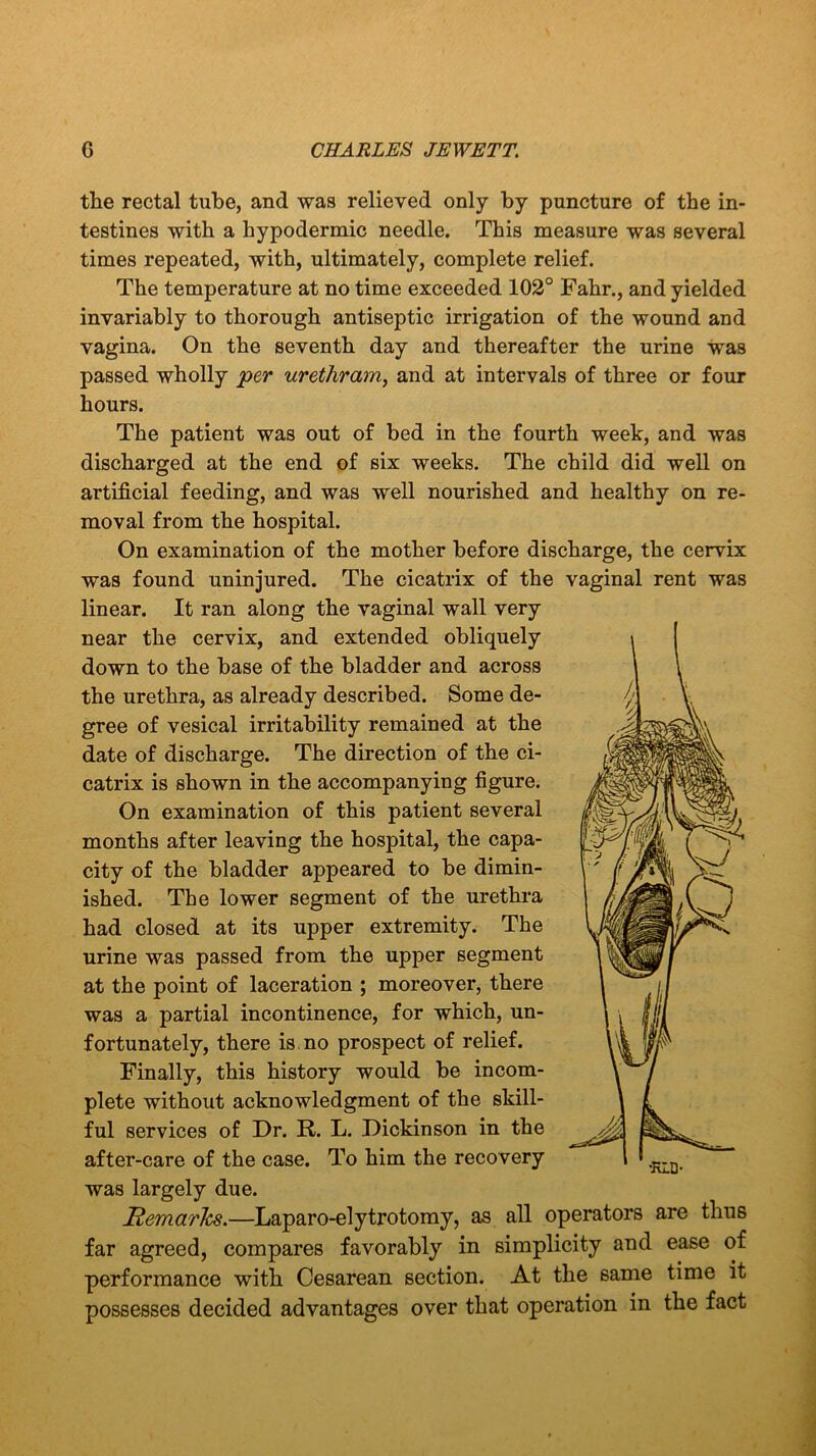 the rectal tube, and was relieved only by puncture of the in- testines with a hypodermic needle. This measure was several times repeated, with, ultimately, complete relief. The temperature at no time exceeded 102° Fahr., and yielded invariably to thorough antiseptic irrigation of the wound and vagina. On the seventh day and thereafter the urine was passed wholly per urethram, and at intervals of three or four hours. The patient was out of bed in the fourth week, and was discharged at the end of six weeks. The child did well on artificial feeding, and was well nourished and healthy on re- moval from the hospital. On examination of the mother before discharge, the cervix was found uninjured. The cicatrix of the vaginal rent was linear. It ran along the vaginal wall very near the cervix, and extended obliquely down to the base of the bladder and across the urethra, as already described. Some de- gree of vesical irritability remained at the date of discharge. The direction of the ci- catrix is shown in the accompanying figure. On examination of this patient several months after leaving the hospital, the capa- city of the bladder appeared to be dimin- ished. The lower segment of the urethra had closed at its upper extremity. The urine was passed from the upper segment at the point of laceration ; moreover, there was a partial incontinence, for which, un- fortunately, there is no prospect of relief. Finally, this history would be incom- plete without acknowledgment of the skill- ful services of Dr. R. L. Dickinson in the after-care of the case. To him the recovery was largely due. jftemarJcs.—Laparo-elytrotomy, as all operators are thus far agreed, compares favorably in simplicity and ease of performance with Cesarean section. At the same time it possesses decided advantages over that operation in the fact