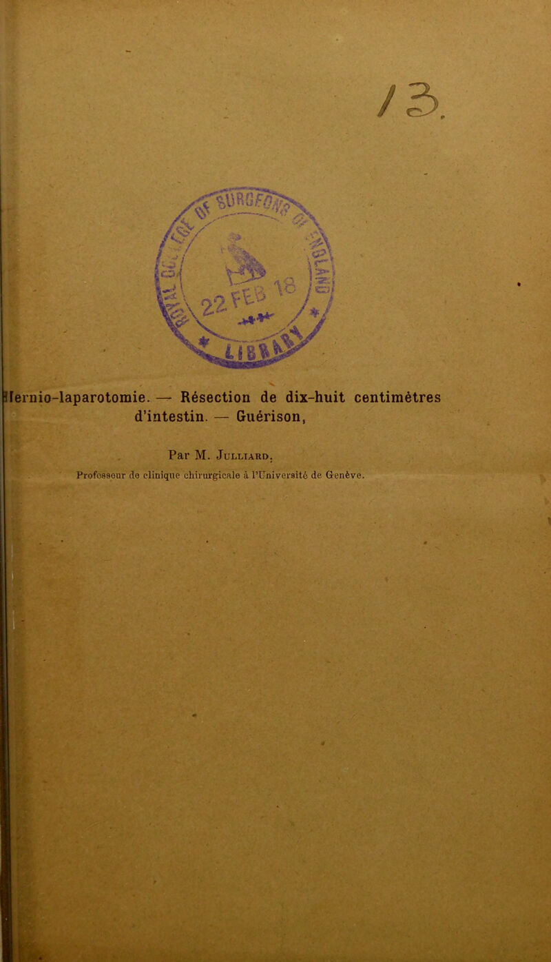 V ilernio-laparotomie. — Résection de dix-huit centimètres d’intestin. — Guérison, Par M. Julltaud. Profossour do clinique chirurgicale à l’Université de Genève.