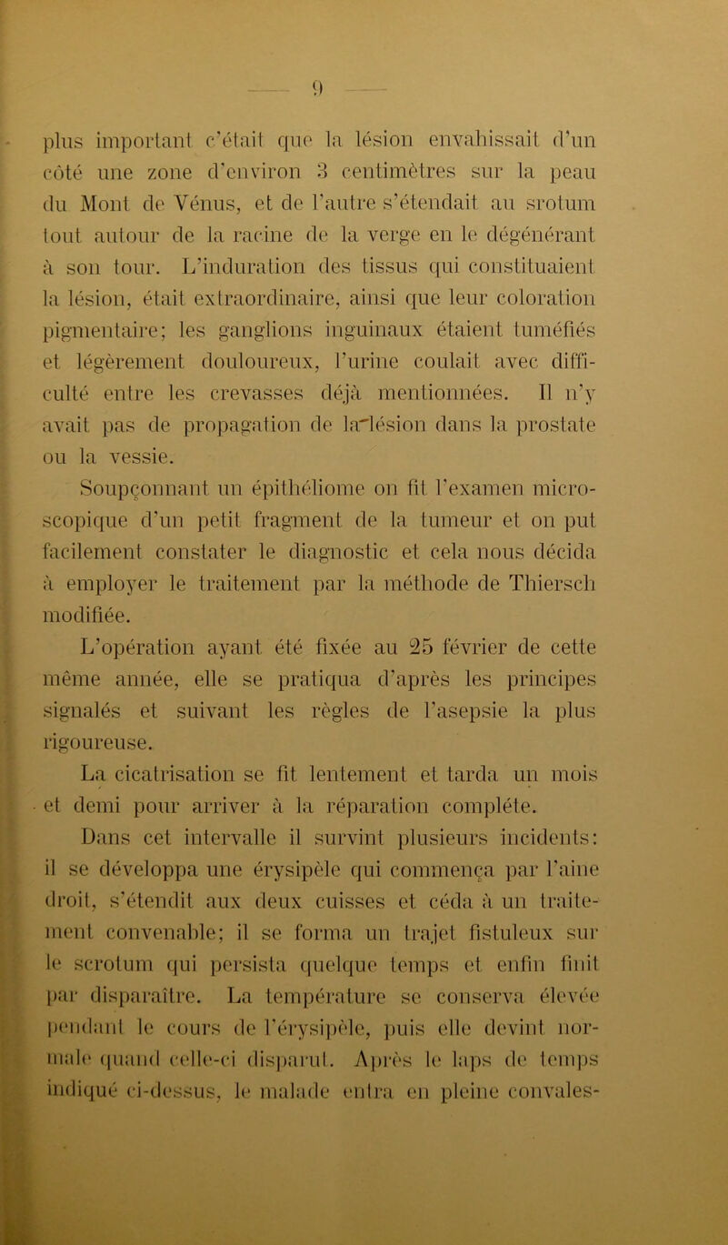 plus important c'était que la lésion envahissait (rnn côté nne zone d’environ 3 centimètres sur la peau du Mont de Vénus, et de l’autre s’étendait au srotum tout autour de la racine de la verge en le dégénérant à son tour. L’induration des tissus qui constituaient la lésion, était extraordinaire, ainsi que leur coloration pigmentaire; les ganglions inguinaux étaient tuméfiés et légèrement douloureux, l’urine coulait avec diffi- culté entre les crevasses déjà mentionnées. Il n’y avait pas de propagation de lalésion dans la prostate ou la vessie. Soupçonnant un épithéliome on fit l’examen micro- scopique d’un petit fragment de la tumeur et on put facilement constater le diagnostic et cela nous décida à employer le traitement par la méthode de Thiersch modifiée. L’opération ayant été fixée au 25 février de cette même année, elle se pratiqua d’après les principes signalés et suivant les règles de l’asepsie la plus rigoureuse. La cicatrisation se fit lentement et tarda un mois et demi pour arriver à la réparation complète. Dans cet intervalle il survint plusieurs incidents: il se développa une érysipèle qui commença par l’aine droit, s’étendit aux deux cuisses et céda à un traite- ment convenable; il se forma un trajet fistuleux sur le scrotum qui persista t[uelque temps et enfin finit par disparaître. La température se conserva élevée p(‘ii(laiil le cours de l’érysi])èle, jiuis elle devint nor- male (juaiid cell(‘-ci disjiarut. A]irès le laps de temps indiqué ci-dessus, le malade entra en pleine convales-