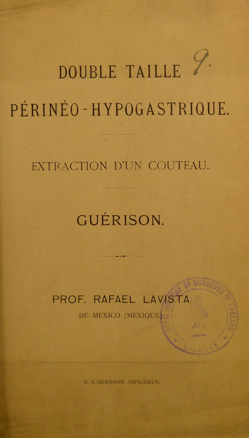 DOUBLE TAILLE / PÉRINÉO-HYPOGASTRIQUE. ; / ' EXTRACTION D’UN COUTEAU. GUÉRISON. PROF. RAFAEL LAVISTA DE MEXICO (MEXIQUE). es »: T** ! 20- j # /