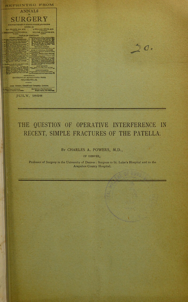 RtCF»RINTKD fTROM. or •na w»w tom i £aL«sSS?sS:S« UiaVERS!TY> OP RENNSYLVAKIA PR£Sa PmUVDEZXHlAJS^ Ofc«t BriamGasmO and Oomptcy. Lonaoa ANNALS SURGERY AvoMTHLV ssvD^.or *tfiEoic*u«cam«*'ANti;.»KAcm eOtrSD BY ti-i fOCHER. AM. UOk J: WlLUAjl wmrm USti. ■ ypfnPtttnt 'tRKtfE&-tJtCSfc WILLIAM MACHWEHflLPi, JULY, 1898 THE QUESTION OF OPERATIVE INTERFERENCE IN RECENT, SIMPLE FRACTURES OF THE PATELLA. By CHARLES A. POWERS, M.D., OF DENVER, Professor of Surgery in the University of Denver; Surgeon to St. Luke’s Hospital and to the