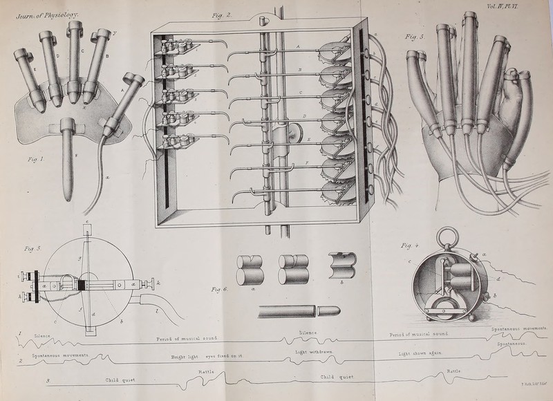 Jourro. of Physiology li/miiWHIWJIDif maiii'*11'/ Period of musical sound. z Spontaneous Bright light eyes fixed on it. 3. Child quiet. Rattle- Vol.JV.Fl.VI Child quiet. T HuQi.LiUf Edinr