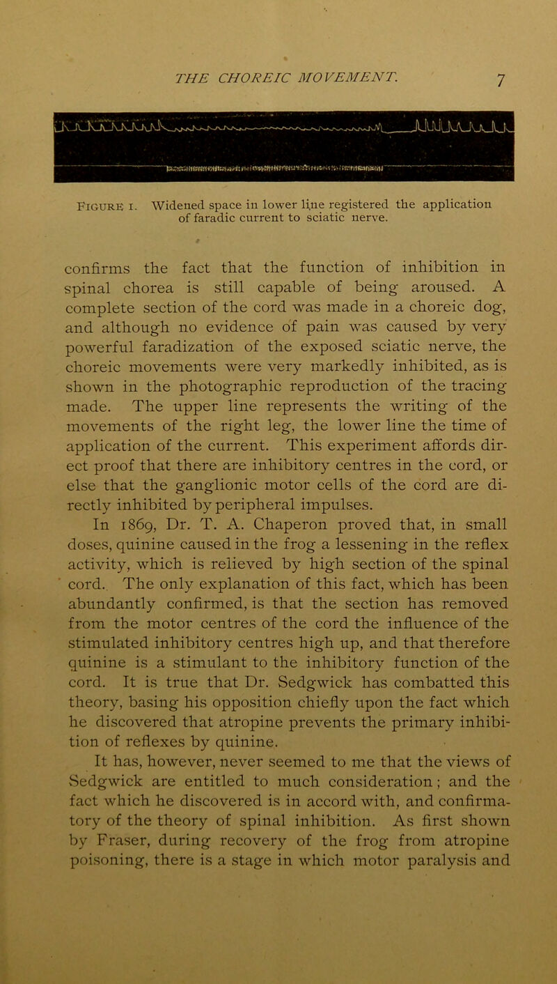 Figure i. Widened space in lower line registered the application of faradic current to sciatic nerve. confirms the fact that the function of inhibition in spinal chorea is still capable of being aroused. A complete section of the cord was made in a choreic dog, and although no evidence of pain was caused by very powerful faradization of the exposed sciatic nerve, the choreic movements were very markedly inhibited, as is shown in the photographic reproduction of the tracing made. The upper line represents the writing of the movements of the right leg, the lower line the time of application of the current. This experiment affords dir- ect proof that there are inhibitory centres in the cord, or else that the ganglionic motor cells of the cord are di- rectly inhibited by peripheral impulses. In 1869, Dr. T. A. Chaperon proved that, in small doses, quinine caused in the frog a lessening in the reflex activity, which is relieved by high section of the spinal cord. The only explanation of this fact, which has been abundantly confirmed, is that the section has removed from the motor centres of the cord the influence of the stimulated inhibitory centres high up, and that therefore quinine is a stimulant to the inhibitory function of the cord. It is true that Dr. Sedgwick has combatted this theory, basing his opposition chiefly upon the fact which he discovered that atropine prevents the primary inhibi- tion of reflexes by quinine. It has, however, never seemed to me that the views of vSedgwick are entitled to much consideration; and the fact which he discovered is in accord with, and confirma- tory of the theory of spinal inhibition. As first shown by Fraser, during recovery of the frog from atropine poisoning, there is a stage in which motor paralysis and