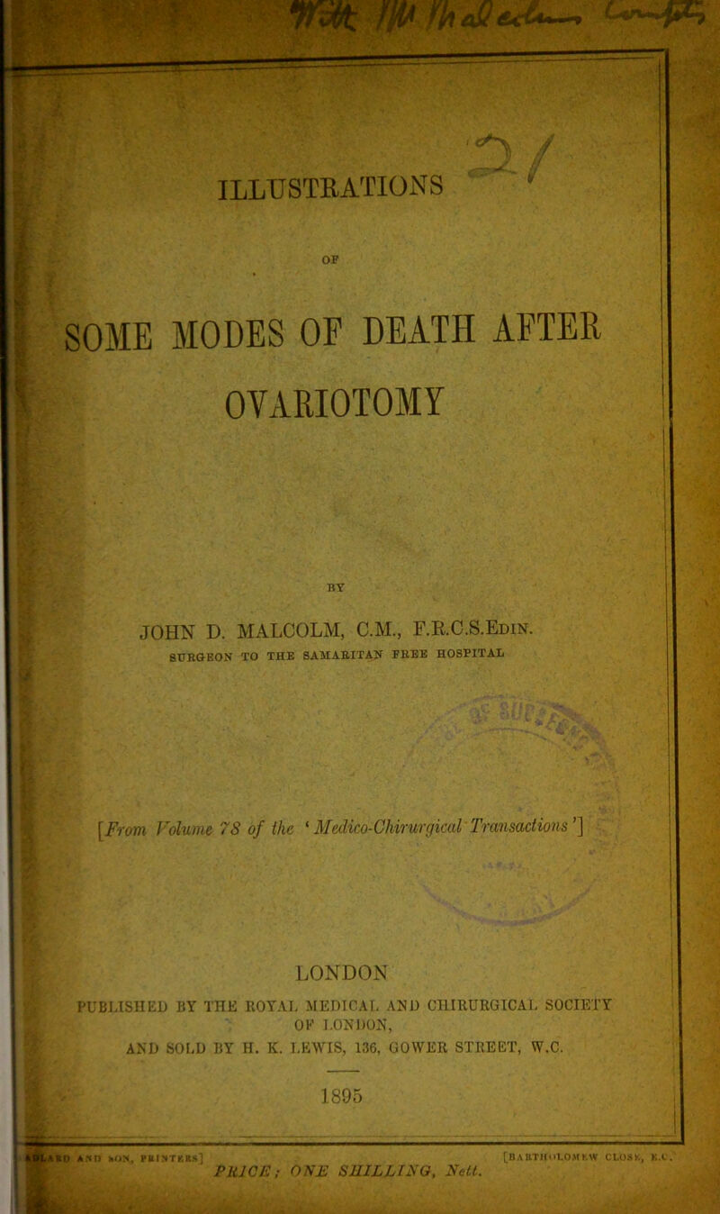 SOME MODES OF DEATH AFTER OVARIOTOMY BY JOHN D. MALCOLM, C.M., F.RC.S.Edin. SURGEON TO THE SAMARITAN TREE HOSPITAL [From Volume 78 of the ‘Medico-Chirurgical Transactions’] ’ - *■•'7 LONDON PUBLISHED BY THE ROYAL MEDICAL AND CI1IRURGICAL SOCIETY OK LONDON, AND SOLD BY H. K. LEWIS, 136, GOWER STREET, W.C. 1895 BD ADD kON, riMMTKRs] PRICE; ONE SHILLING, Nett. [BAUTIIoLOMf.W CLOSK, K.C.