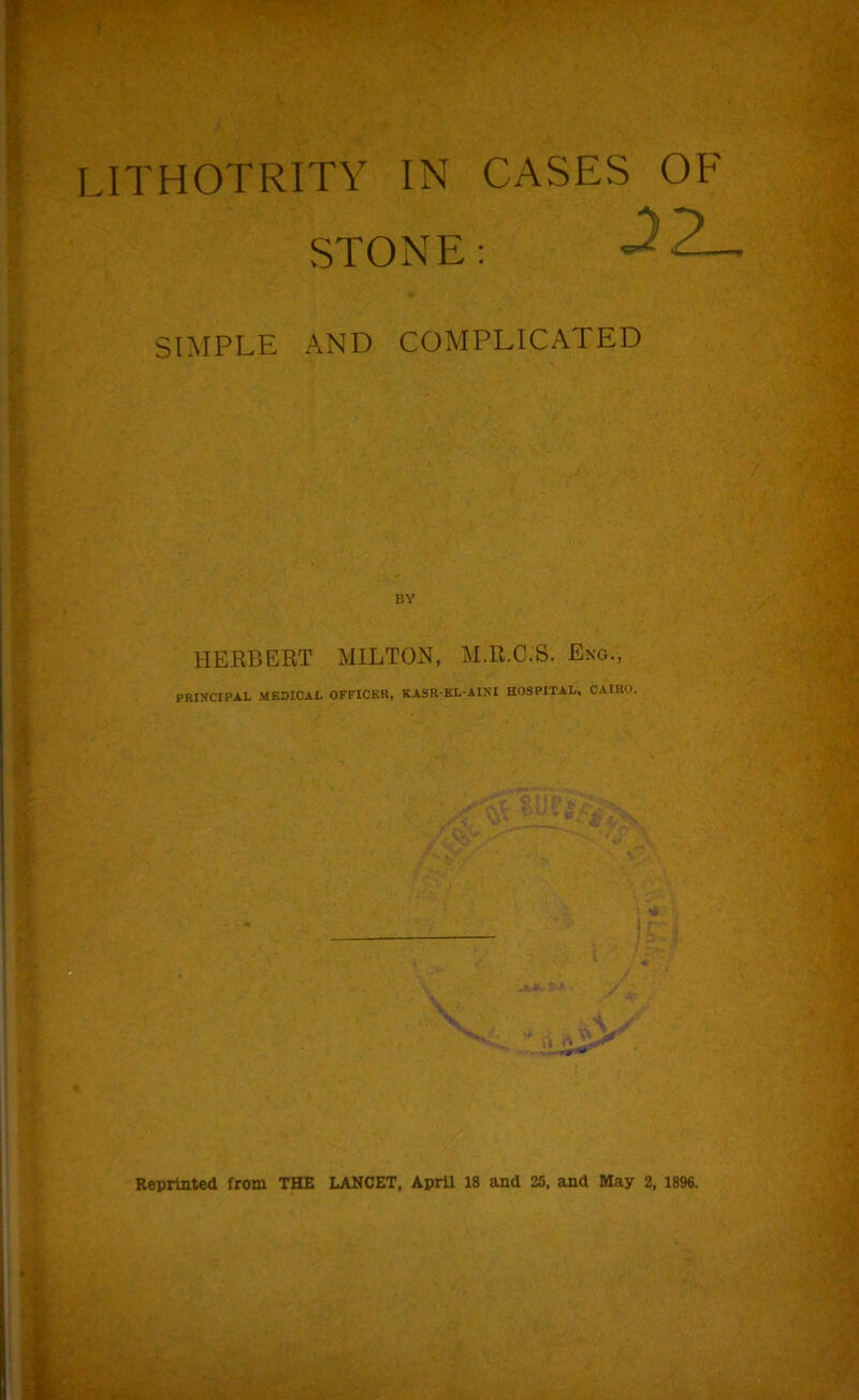 LITHOTRITY IN CASES OF STONE: SIMPLE AND COMPLICATED BY HERBERT MILTON, M.R.C.S. Eng., PRISCIPAL MEDICAL OFFICER, KASR-KL-AINI HOSPITAL. CAIRO. JiL / -