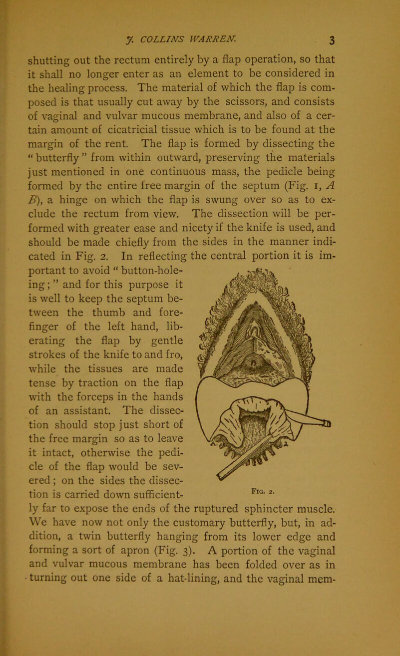 shutting out the rectum entirely by a flap operation, so that it shall no longer enter as an element to be considered in the healing process. The material of which the flap is com- posed is that usually cut away by the scissors, and consists of vaginal and vulvar mucous membrane, and also of a cer- tain amount of cicatricial tissue which is to be found at the margin of the rent. The flap is formed by dissecting the “ butterfly ” from within outward, preserving the materials just mentioned in one continuous mass, the pedicle being formed by the entire free margin of the septum (Fig. i, A B), a hinge on which the flap is swung over so as to ex- clude the rectum from view. The dissection will be per- formed with greater ease and nicety if the knife is used, and should be made chiefly from the sides in the manner indi- cated in Fig. 2. In reflecting the central portion it is im- portant to avoid “ button-hole- ing; ” and for this purpose it is well to keep the septum be- tween the thumb and fore- finger of the left hand, lib- erating the flap by gentle strokes of the knife to and fro, while the tissues are made tense by traction on the flap with the forceps in the hands of an assistant. The dissec- tion should stop just short of the free margin so as to leave it intact, otherwise the pedi- cle of the flap would be sev- ered ; on the sides the dissec- tion is carried down sufficient- ly far to expose the ends of the ruptured sphincter muscle. We have now not only the customary butterfly, but, in ad- dition, a twin butterfly hanging from its lower edge and and vulvar mucous membrane has been folded over as in ■ turning out one side of a hat-lining, and the vaginal mem-