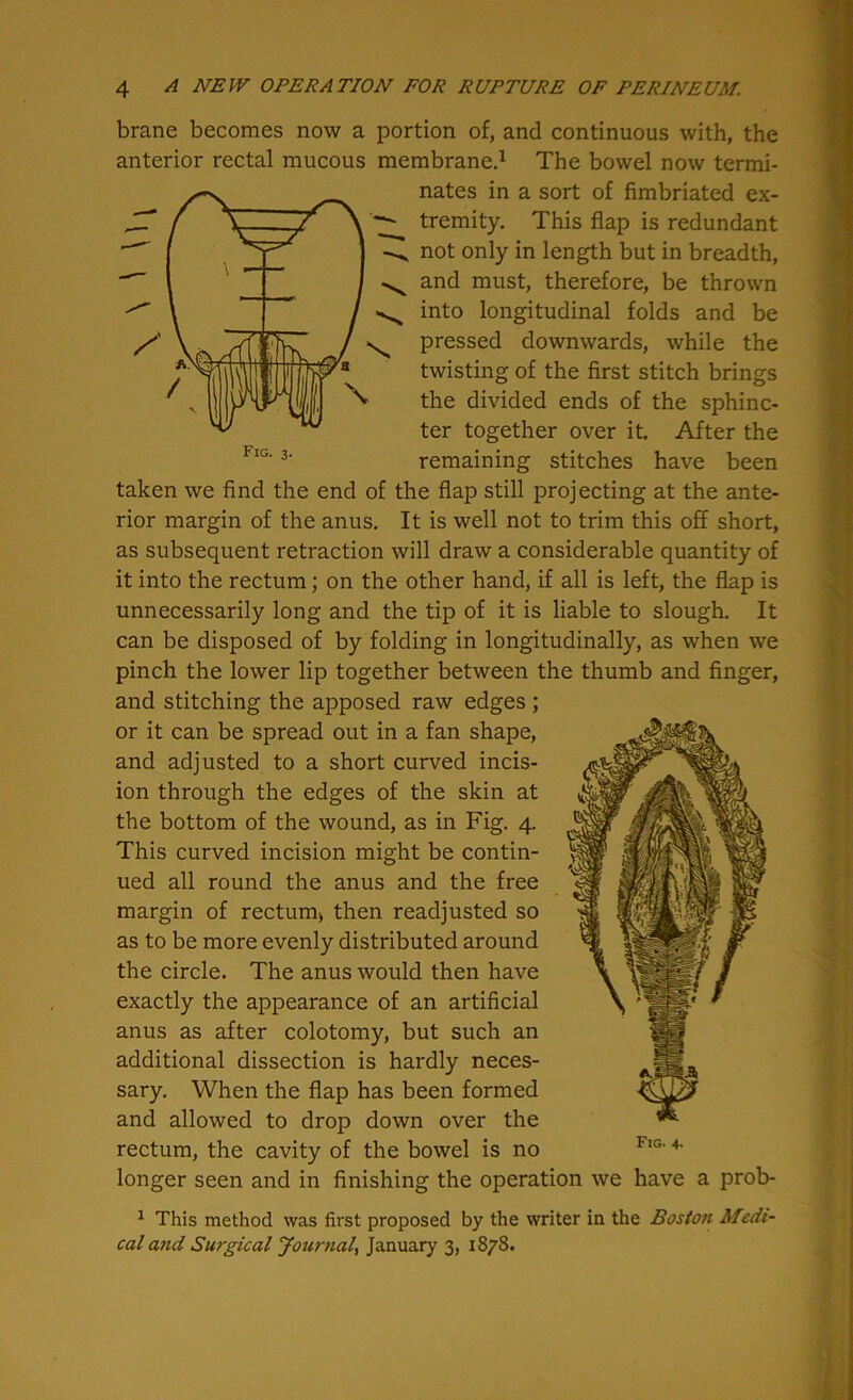 Fig. 3. brane becomes now a portion of, and continuous with, the anterior rectal mucous membrane.1 The bowel now termi- nates in a sort of fimbriated ex- tremity. This flap is redundant not only in length but in breadth, and must, therefore, be thrown into longitudinal folds and be pressed downwards, while the twisting of the first stitch brings the divided ends of the sphinc- ter together over it. After the remaining stitches have been taken we find the end of the flap still projecting at the ante- rior margin of the anus. It is well not to trim this off short, as subsequent retraction will draw a considerable quantity of it into the rectum; on the other hand, if all is left, the flap is unnecessarily long and the tip of it is liable to slough. It can be disposed of by folding in longitudinally, as when we pinch the lower lip together between the thumb and finger, and stitching the apposed raw edges ; or it can be spread out in a fan shape, and adjusted to a short curved incis- ion through the edges of the skin at the bottom of the wound, as in Fig. 4. This curved incision might be contin- ued all round the anus and the free margin of rectum) then readjusted so as to be more evenly distributed around the circle. The anus would then have exactly the appearance of an artificial anus as after colotomy, but such an additional dissection is hardly neces- sary. When the flap has been formed and allowed to drop down over the rectum, the cavity of the bowel is no longer seen and in finishing the operation we have a prob- 1 This method was first proposed by the writer in the Boston Medi- cal and Surgical Journal, January 3, 1878.