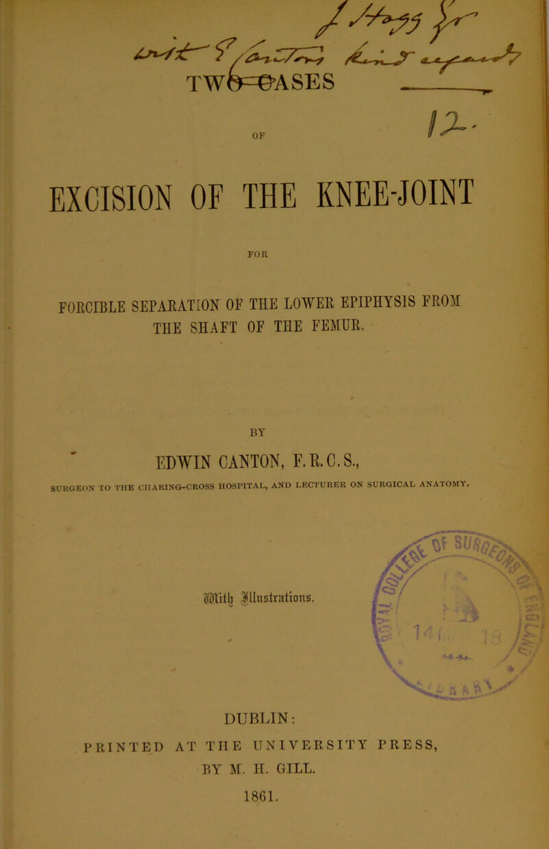 EXCISION OF THE KNEE-JOINT FOR FOECIBLE SEPARATION OF THE LOWER EPIPHYSIS FROM THE SHAFT OF THE FEMUR. BY EDWIN CANTON, E.K.C.S., SUKGE(>N TO THE CIIARING-CROSS HOSPITAL, AND LECTURER ON SURGICAL ANATOMY. ?DUtb IllustrattoiTS. DUBLIN: PRINTED AT THE UNIVERSITY PRESS,