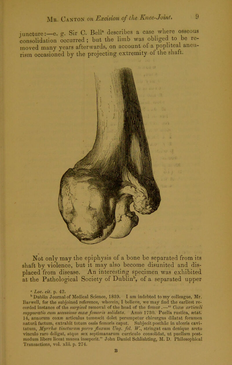 jimcture:—e. g. Sir C. Boll^ describes a case where osseous consolidation occurred ; but the limb was obliged to be re- moved many years afterwards, on account of a popliteal aneu- rism occasioned by the projecting extremity of the shaft. Not only may the epiphysis of a hone be separated from its shaft by violence, but it may also become disunited and dis- placed from disease. An interesting specimen was exhibited at the Pathological Society of Dublin’’, of a separated upper * Loc. cit. p. 42. Dublin Journal of Medical Science, 1839. I am indebted to my colleague, Mr. Harwell, for the subjoined reference, wherein, I believe, wo may find the earliest re- corded instance of the surgical removal of the head of the femur .—“ Coxm articuH suppuratio cum secessione coxm femoris solidata. Anno 1730. Puella rustica, retat. 14, annorura coxm articulus tume.scit dolet perumpetur chinirgus dilatat foramen natttrd factum, extrahit totum ossis femoris caput. Subjecitposthfic in ulceris cavi- tatum, Myrrhcc tincturam porro Jluxum Ting. fel. TF., stringat earn deniquc arcto vinculo raro deligat, atque sex septimanariim curriculo consolidat, ut puellam post- modum libere liceat manca inseperit.” John Daniel Schlishting, M. D. Philosophical Transactioas, vol. xlii. p. 274. D