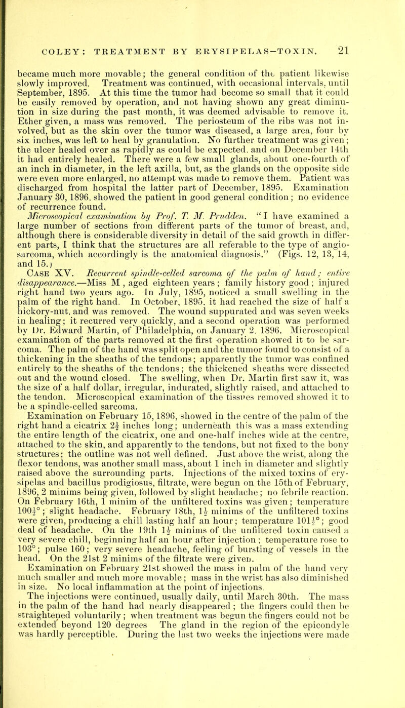 became much more movable; the general condition of the patient likewise slowly improved. Treatment was continued, with occasional intervals, until September, 1895. At this time the tumor had become so small that it could be easily removed by operation, and not having shown any great diminu- tion in size during the past month, it was deemed advisable to remove it. Ether given, a mass was removed. The periosteum of the ribs was not in- volved, but as the skin over the tumor was diseased, a large area, four by six inches, was left to heal by granulation. No further treatment was given; the ulcer healed over as rapidly as could be expected, and on December 14th it had entirely healed. There were a few small glands, about one-fourth of an inch in diameter, in the left axilla, but, as the glands on the opposite side were even more enlarged, no attempt was made to remove them. Patient was discharged from hospital the latter part of December, 1895. Examination January 30, 1896, showed the patient in good general condition ; no evidence of recurrence found. Microscopical examination by Prof. T. M. Prudden. “ I have examined a large number of sections from different parts of the tumor of breast, and, although there is considerable diversity in detail of the said growth in differ- ent parts, I think that the structures are all referable to the type of angio- sarcoma, which accordingly is the anatomical diagnosis.” (Figs. 12, 13, 14, and 15.) Case XV. Recurrent spindle-celled sarcoma of the palm of hand; entire disappearance.—Miss M , aged eighteen years ; family history good ; injured right hand two years ago. In July, 1895, noticed a small swelling in the palm of the right hand. In October, 1895, it had reached the size of half a hickory-nut, and was removed. The wound suppurated and was seven weeks in healing; it recurred very quickly, and a second operation was performed by Dr. Edward Martin, of Philadelphia, on January 2. 1896. Microscopical examination of the parts removed at the first operation showed it to be sar- coma. The palm of the hand was split open and the tumor found to consist of a thickening in the sheaths of the tendons; apparently the tumor was confined entirely to the sheaths of the tendons ; the thickened sheaths were dissected out and the wound closed. The swelling, when Dr. Martin first saw it, was the size of a half dollar, irregular, indurated, slightly raised, and attached to the tendon. Microscopical examination of the tissues removed showed it to be a spindle-celled sarcoma. Examination on February 15,1896, showed in the centre of the palm of the right hand a cicatrix 2| inches long; underneath this was a mass extending the entire length of the cicatrix, one and one-half inches wide at the centre, attached to the skin, and apparently to the tendons, but not fixed to the bony structures; the outline was not well defined. Just above the wrist, along the flexor tendons, was another small mass, about 1 inch in diameter and slightly raised above the surrounding parts. Injections of the mixed toxins of ery- sipelas and bacillus prodigiosus, filtrate, were begun on the 15th of February, 1896, 2 minims being given, followed by slight headache ; no febrile reaction. On February 16th, 1 minim of the unfiltered toxins was given; temperature lOOj®; slight headache. February 18th, 14 minims of the unfiltered toxins were given, producing a chill lasting half an hour; temperature 1014°; good deal of headache. On the 19th 1^ minims of the unfiltered toxin caused a very severe chill, beginning half an hour after injection ; temperature rose to 103°; pulse 160; very severe headache, feeling of bursting of vessels in the head. On the 21st 2 minims of the filtrate were given. Examination on February 21st showed the mass in palm of the hand very much smaller and much more movable ; mass in the wrist has also diminished in size. No local inflammation at the point of injections. The injections were continued, usually daily, until March 30th. The mass in the palm of the hand had nearly disappeared ; the fingers could then be straightened voluntarily ; when treatment was begun the fingers could not be extended beyond 120 degrees The gland in the region of the epicondyle was hardly perceptible. During the last two weeks the injections were made