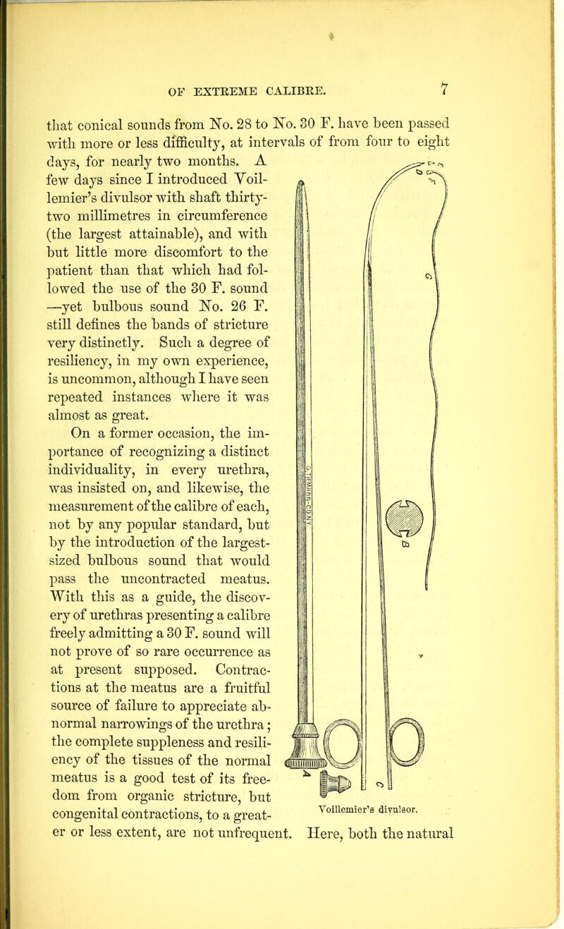 that conical sounds from 28 to E'o. 30 F. have been passed with more or less difficulty, at intervals of from four to eight days, for nearly two months. A few days since I introduced Yoil- lemier’s divulsor with shaft thirty- two millimetres in circumference (the largest attainable), and with but little more discomfort to the patient than that which had fol- lowed the use of the 30 F. sound —yet bulbous sound FTo. 26 F. still defines the bands of stricture very distinctly. Such a degree of resiliency, in my own experience, is uncommon, although I have seen repeated instances wliere it was almost as great. On a former occasion, the im- portance of recognizing a distinct individuality, in every urethra, was insisted on, and likewise, the measurement of the calibre of each, not by any popular standard, but by the introduction of the largest- sized bulbous sound that would pass the uncontracted meatus. With this as a guide, the discov- ery of urethras presenting a calibre freely admitting a 30 F. sound will not prove of so rare occurrence as at present supposed. Contrac- tions at the meatus are a fruitful source of failure to appreciate ab- normal narrowings of the urethra; the complete suppleness and resili- ency of the tissues of the normal meatus is a good test of its free- dom from organic stricture, but congenital contractions, to a great- er or less extent, are not unfrequent. Here, both the natural Voillemier’s divulsor.