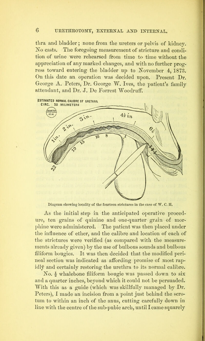 tlira and bladder ; none from the ureters or pelvis of kidney. No casts. The foregoing measurement of stricture and condi- tion of urine were rehearsed from time to time without the appreciation of any marked changes, and with no further prog- ress toward entering the bladder up to November 4, 1873. On this date an operation was decided upon. Present Dr. George A. Peters, Dr. George W. Ives, the patient’s family attendant, and Dr. <7. De Forrest Woodruff. ESTIMATED NORMAL CALIBRE OF URETHRA Diagram showing locality of the fourteen strictures in the case of W. C. H. As the initial step in the anticipated operative proced- ure, ten grains of quinine and one-quarter grain of mor- phine were administered. The patient was then placed under the influence of ether, and the calibre and location of each of the strictures were verified (as compared with the measure- ments already given) by the use of bulbous sounds and bulbous filiform bougies. It was then decided that the modified peri- neal section was indicated as affording promise of most rap- idly and certainly restoring the urethra to its normal calibre. No. i wffalebone filiform bougie was passed down to six and a quarter inches, beyond which it could not be persuaded. With this as a guide (which was skillfully managed by Dr. Peters), I made an incision from a point just behind the scro- tum to within an inch of the anus, cutting carefully down in line with the centre of the sub-pubic arch, until I came squarely