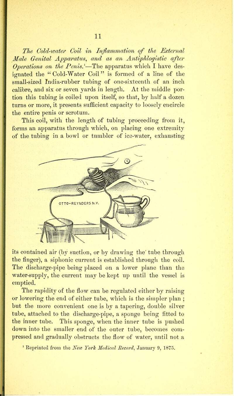 The Cold-water Coil in Inflammation of the External Male Genital Apparatus^ and as an Antiphlogistic after Operations on the Penis.'—The apparatus which I have des- io-uated the “Cold-Water Coil” is formed of a line of the small-sized India-rubber tubing of one-sixteenth of an inch calibre, and six or seven yards in length. At tlie middle por- tion this tubing is coiled upon itself, so that, by half a dozen turns or more, it presents sufficient capacity to loosely encircle the entire penis or scrotum. This coil, with the length of tubing proceeding from it, forms an apparatus through which, on placing one extremity of the tubing in a bowl or tumbler of ice-water, exhausting its contained air (by suction, or by drawing the' tube through the finger), a siphonic current is established through the coil. The discharge-pipe being placed on a lower plane than the water-supply, the current may be kept up until the vessel is emptied. The rapidity of the flow can be regulated either by raising or lowering the end of either tube, which is the simpler plan ; but the more convenient one is by a tapering, double silver tube, attached to the discharge-pipe, a sponge being fitted to the inner tube. This sponge, when the inner tube is pushed down into the smaller end of the outer tube, becomes com- pressed and gradually obstructs the flow of water, until not a ^ Eeprinted from the Neic York Medical Record.^ January 9, 1875.