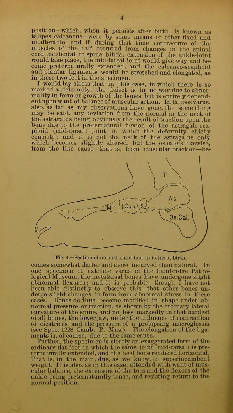 position—which, when it persists after birth, is known as talipes calcaneus—were by some means or other fixed and unalterable, and if during that time contracture of the muscles of the calf occurred from changes in the spinal cord incidental to spina bifida, extension of the ankle-joint would take place, the mid-tarsal joint would give way and be- come preternaturally extended, and the calcaneo-scaphoid and plantar ligaments would be stretched and elongated, as in these two feet in the specimen. I would lay stress that in this case, in which there is so marked a deformity, the defect is in no way due to abnor- mality in form or growth of the bones, but is entirely depend- ent upon want of balance of muscular action. In talipes varus, also, as far as my observations have gone, the same thing may be said, any deviation from the normal in the neck of the astragalus being obviously the result of traction upon the bone due to the preternatural flexion of the astragalo-sca- phoid (mid-tarsal) joint in which the deformity chiefly consists ; and it is not the neck of the astragalus only which becomes slightly altered, but the os calcis likewise, from the like cause—that is, from muscular traction—be- Fig. 4.—Section of normal riglit foot in foetus at birth. comes somewhat flatter and more incurved than natural. In one specimen of extreme varus in the Cambridge Patho- logical Museum, the metatarsal bones have undergone slight abnormal flexures; and it is probable- though I have not been able distinctly to observe this—that other bones un- dergo slight changes in form from abnormal stress in these cases. Bones do thus become modified in shape under ab- normal pressure or traction, as shown by the ordinary lateral curvature of the spine, and no less markedly in that hardest of all bones, the lower jaw, under the influence of contraction of cicatrices and the pressure of a prolapsing macroglossia (see Spec. 1228 Camb. P. Mus.). The elongation of the liga- ments is, of course, due to the same cause. Further, the specimen is clearly an exaggerated form of the ordinary flat foot in which the same joint (mid-tarsal) is pre- ternaturally extended, and the heel bone rendered horizontal. That is, in the main, due, as we know, to superincumbent weight. It is also, as in this case, attended with want of mus- cular balance, the extensors of the toes and the flexors of the ankle being preternaturally tense, and resisting return to the normal position.