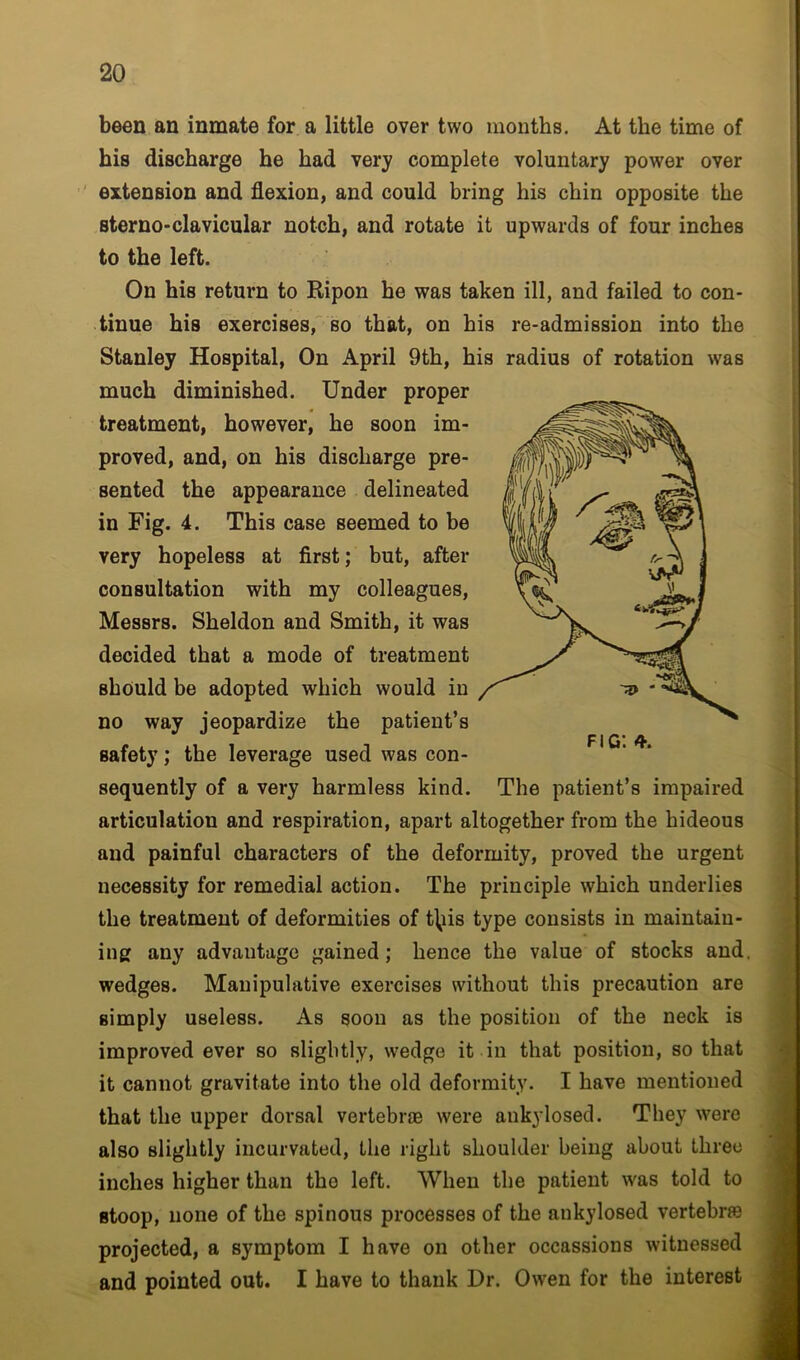 been an inmate for a little over two months. At the time of his discharge he had very complete voluntary power over extension and flexion, and could bring his chin opposite the sterno-clavicular notch, and rotate it upwards of four inches to the left. On his return to Ripon he was taken ill, and failed to con- tinue his exercises, so that, on his re-admission into the Stanley Hospital, On April 9th, his radius of rotation was much diminished. Under proper treatment, however, he soon im- proved, and, on his discharge pre- sented the appearance delineated in Fig. 4. This case seemed to be very hopeless at first; but, after consultation with my colleagues, Messrs. Sheldon and Smith, it was decided that a mode of treatment should be adopted which would in no way jeopardize the patient’s safety; the leverage used was con- sequently of a very harmless kind. The patient’s impaired articulation and respiration, apart altogether from the hideous and painful characters of the deformity, proved the urgent necessity for remedial action. The principle which underlies the treatment of deformities of t\iis type consists in maintain- ing any advantage gained; hence the value of stocks and. wedges. Manipulative exercises without this precaution are simply useless. As soon as the position of the neck is improved ever so slightly, wedge it in that position, so that it cannot gravitate into the old deformity. I have mentioned that the upper dorsal vertebrae were aukylosed. They were also slightly incurvated, the right shoulder being about three inches higher than the left. When the patient was told to stoop, none of the spinous processes of the aukylosed vertebra projected, a symptom I have on other occassions witnessed and pointed out. I have to thank Dr. Owen for the interest