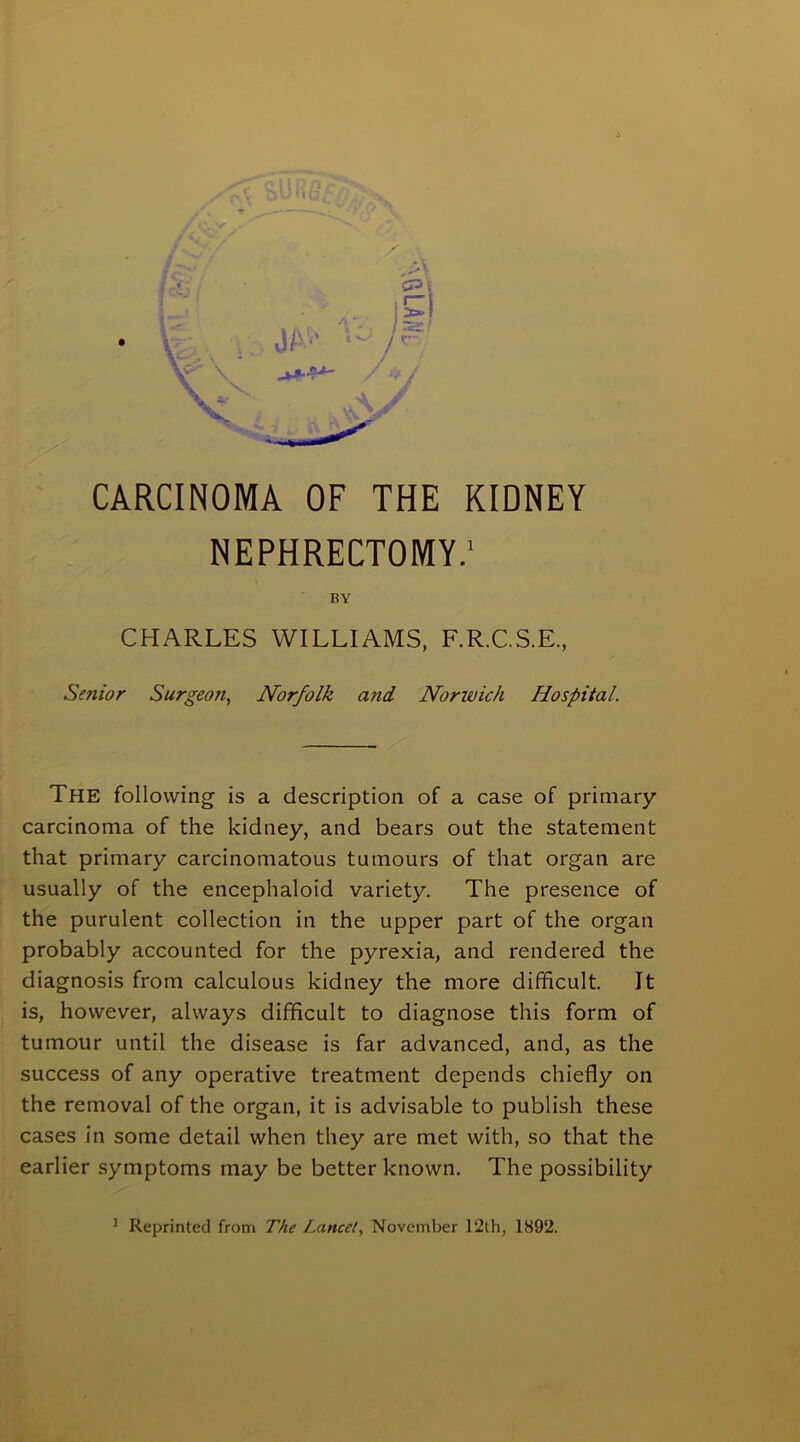 /* ys f qU n U CARCINOMA OF THE KIDNEY NEPHRECTOMY.1 BY CHARLES WILLIAMS, F.R.C.S.E., Senior Surgeon, Norfolk and Norwich Hospital. The following is a description of a case of primary carcinoma of the kidney, and bears out the statement that primary carcinomatous tumours of that organ are usually of the encephaloid variety. The presence of the purulent collection in the upper part of the organ probably accounted for the pyrexia, and rendered the diagnosis from calculous kidney the more difficult. It is, however, always difficult to diagnose this form of tumour until the disease is far advanced, and, as the success of any operative treatment depends chiefly on the removal of the organ, it is advisable to publish these cases in some detail when they are met with, so that the earlier symptoms may be better known. The possibility