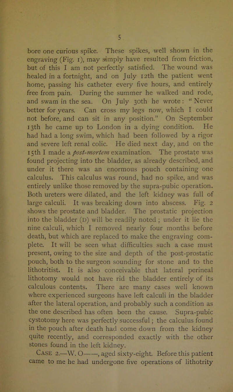 bore one curious spike. These spikes, well shown in the engraving (Fig. i), may simply have resulted from friction, but of this I am not perfectly satisfied. The wound was healed in a fortnight, and on July 12th the patient went home, passing his catheter every five hours, and entirely free from pain. During the summer he walked and rode, and swam in the sea. On July 30th he wrote: “Never better for years. Can cross my legs now, which I could not before, and can sit in any position.” On September 13th he came up to London in a dying condition. He had had a long swim, which had been followed by a rigor and severe left renal colic. He died next day, and on the 15th I made a post-mortem examination. The prostate was found projecting into the bladder, as already described, and under it there was an enormous pouch containing one calculus. This calculus was round, had no spike, and was entirely unlike those removed by the supra-pubic operation. Both ureters were dilated, and the left kidney was full of large calculi. It was breaking down into abscess. Fig. 2 shows the prostate and bladder. The prostatic projection into the bladder (D) will be readily noted ; under it lie the nine calculi, which I removed nearly four months before death, but which are replaced to make the engraving com- plete. It will be seen what difficulties such a case must present, owing to the size and depth of the post-prostatic pouch, both to the surgeon sounding for stone and to the lithotritist. It is also conceivable that lateral perineal lithotomy would not have rid the bladder entirely of its calculous contents. There are many cases well known where experienced surgeons have left calculi in the bladder after the lateral operation, and probably such a condition as the one described has often been the cause. Supra-pubic cystotomy here was perfectly successful; the calculus found in the pouch after death had come down from the kidney quite recently, and corresponded exactly with the other stones found in the left kidney. CASE 2.—W. O , aged sixty-eight. Before this patient came to me he had undergone five operations of lithotrity