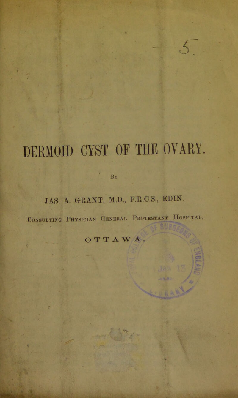 DERMOID CYST OF THE OVARY. By JAS. A. GEANT, M.D., F.E.C.S., EDIN. Consulting Phtsioian General Protestant Hospital, OTTAWA. t TUv/a'