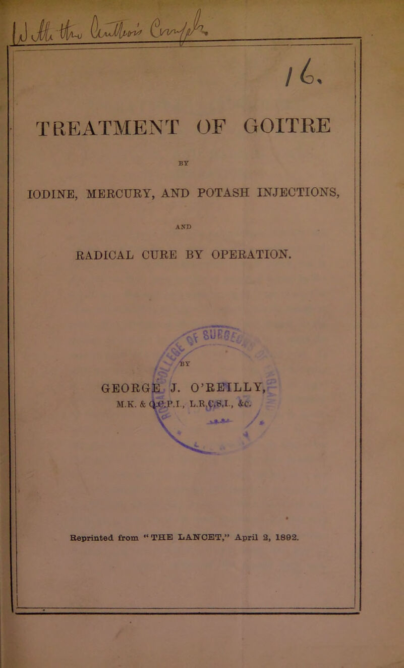 IJ (iW/A /£. T UK ATM ENT OF GOITRE BY IODINE, MERCURY, AND POTASH INJECTIONS, AND RADICAL CURE BY OPERATION. . -- GEORGE J. O’REILLY, M.K. & Q.C.P.I, L.R.^S.I., &C. ■**•**- / * 4 Reprinted from “THE LANCET,” April 2, 1892.