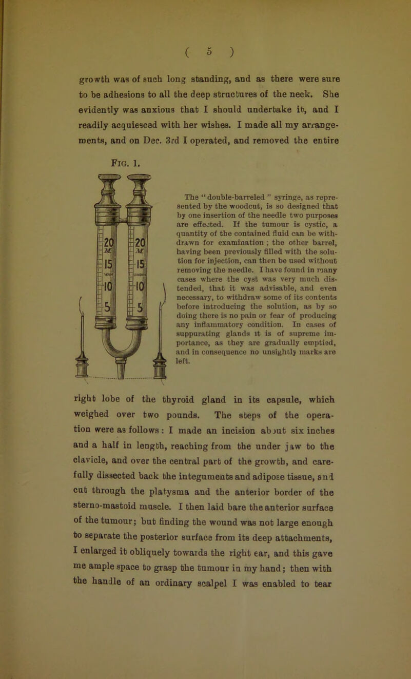 growth was of such long standing, and as there were sure to be adhesions to all the deep structures of the neck. She evidently was anxious that I should undertake it, and I readily acquiesced with her wishes. I made all my arrange- ments, and on Dec. 3rd I operated, and removed the entire Fig. 1. The “ double-barreled ” syringe, as repre- sented by the woodcut, is so designed that by one insertion of the needle two purposes are effected. If the tumour is cystic, a quantity of the contained fluid can be with- drawn for examination ; the other barrel, having been previously filled with the solu- tion for injection, can then be used without removing the needle. I have found in many cases where the cyst was very much dis- tended, that it was advisable, and even necessary, to withdraw some of its contents before introducing the solution, as by so doing there is no pain or fear of producing any inflammatory condition. In cases of suppurating glands it is of supreme im- portance, as they are gradually emptied, and in consequence no unsightly marks are left. righb lobe of the thyroid gland in its capsule, which weighed over two pounds. The steps of the opera- tion were as follows: I made an incision ab jut six inches and a half in length, reaching from the under jaw to the clavicle, and over the central part of the growth, and care- fully dissected back the integuments and adipose tissue, and cut through the platysma and the anterior border of the sterno-mastoid muscle. I then laid bare the anterior surface of the tumour; but finding the wound was not large enough to separate the posterior surface from its deep attachments, I enlarged it obliquely towards the right ear, and this gave me ample space to grasp the tumour in my hand; then with the handle of an ordinary scalpel I was enabled to tear