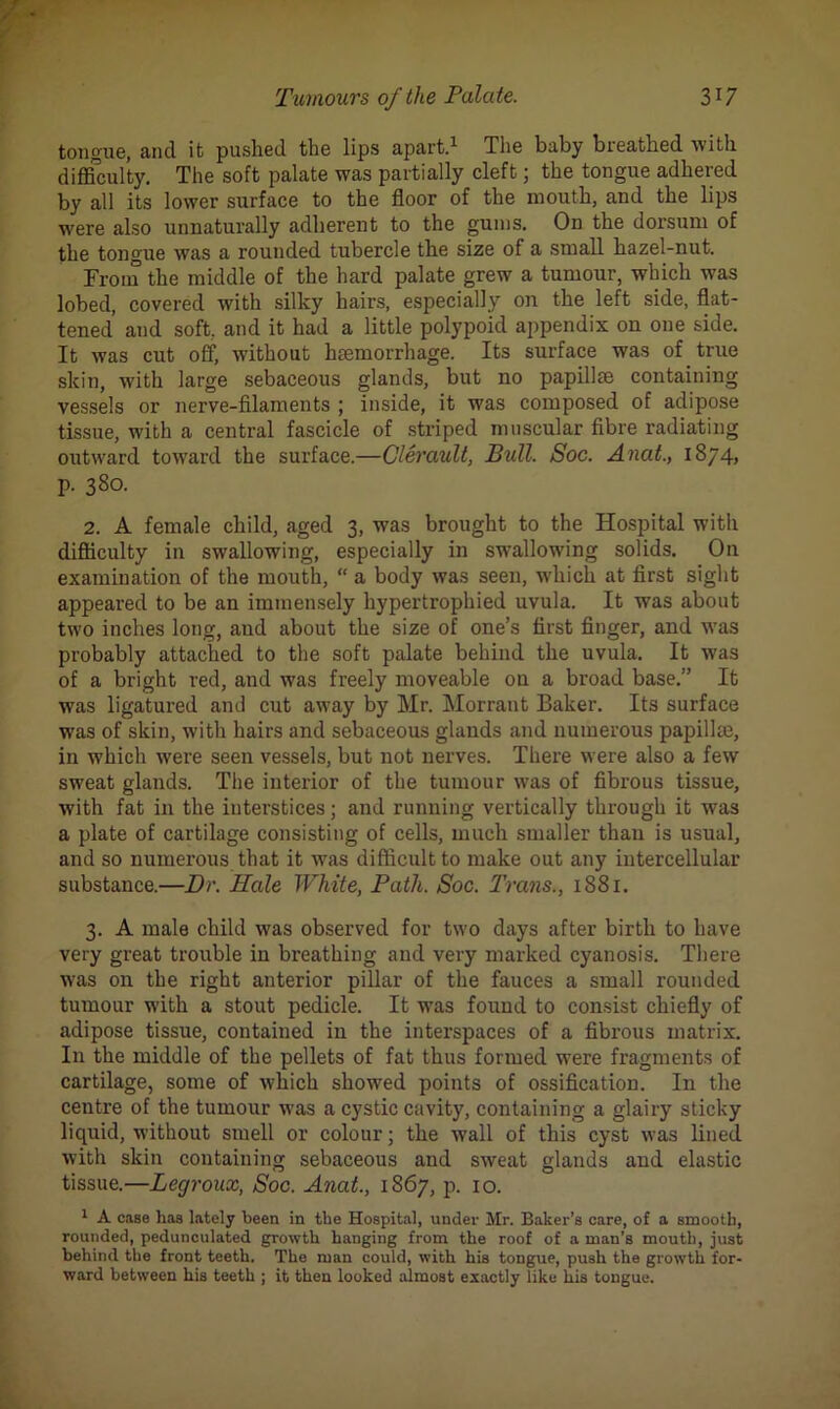 tongue, and it pushed the lips apart.1 The baby breathed with difficulty. The soft palate was partially cleft; the tongue adhered by all its lower surface to the floor of the mouth, and the lips were also unnaturally adherent to the gums. On the dorsum of the tongue was a rounded tubercle the size of a small hazel-nut. From the middle of the hard palate grew a tumour, which was lobed, covered with silky hairs, especially on the left side, flat- tened’ and soft, and it had a little polypoid appendix on one side. It was cut off, without haemorrhage. Its surface was of true skin, with large sebaceous glands, but no papillae containing vessels or nerve-filaments ; inside, it was composed of adipose tissue, with a central fascicle of striped muscular fibre radiating outward toward the surface.—Clerault, Bull. Soc. Anat., 1874* p. 380. 2. A female child, aged 3, was brought to the Hospital with difficulty in swallowing, especially in swallowing solids. On examination of the mouth, “ a body was seen, which at first sight appeared to be an immensely hypertrophied uvula. It was about two inches long, and about the size of one’s first finger, and was probably attached to the soft palate behind the uvula. It was of a bright red, and was freely moveable on a broad base.” It was ligatured and cut away by Mr. Morrant Baker. Its surface was of skin, with hairs and sebaceous glands and numerous papillte, in which were seen vessels, but not nerves. There were also a few sweat glands. The interior of the tumour was of fibrous tissue, with fat in the interstices; and running vertically through it w3 * * * 7as a plate of cartilage consisting of cells, much smaller than is usual, and so numerous that it was difficult to make out any intercellular substance.—Dv. Hale White, Path. Soc. Trans., 1881. 3. A male child was observed for two days after birth to have very great trouble in breathing and very marked cyanosis. There was on the right anterior pillar of the fauces a small rounded tumour with a stout pedicle. It was found to consist chiefly of adipose tissue, contained in the interspaces of a fibrous matrix. In the middle of the pellets of fat thus formed were fragments of cartilage, some of which showed points of ossification. I11 the centre of the tumour was a cystic cavity, containing a glairy sticky liquid, without smell or colour; the wall of this cyst was lined with skin containing sebaceous and sweat glands and elastic tissue.—Lecjroux, Soc. Anat., 1867, p. 10. 1 A case has lately been in the Hospital, under Mr. Baker’s care, of a smooth, rounded, pedunculated growth hanging from the roof of a man’s mouth, just behind the front teeth. The man could, with his tongue, push the growth for- ward between his teeth ; it then looked almost exactly like his tongue.