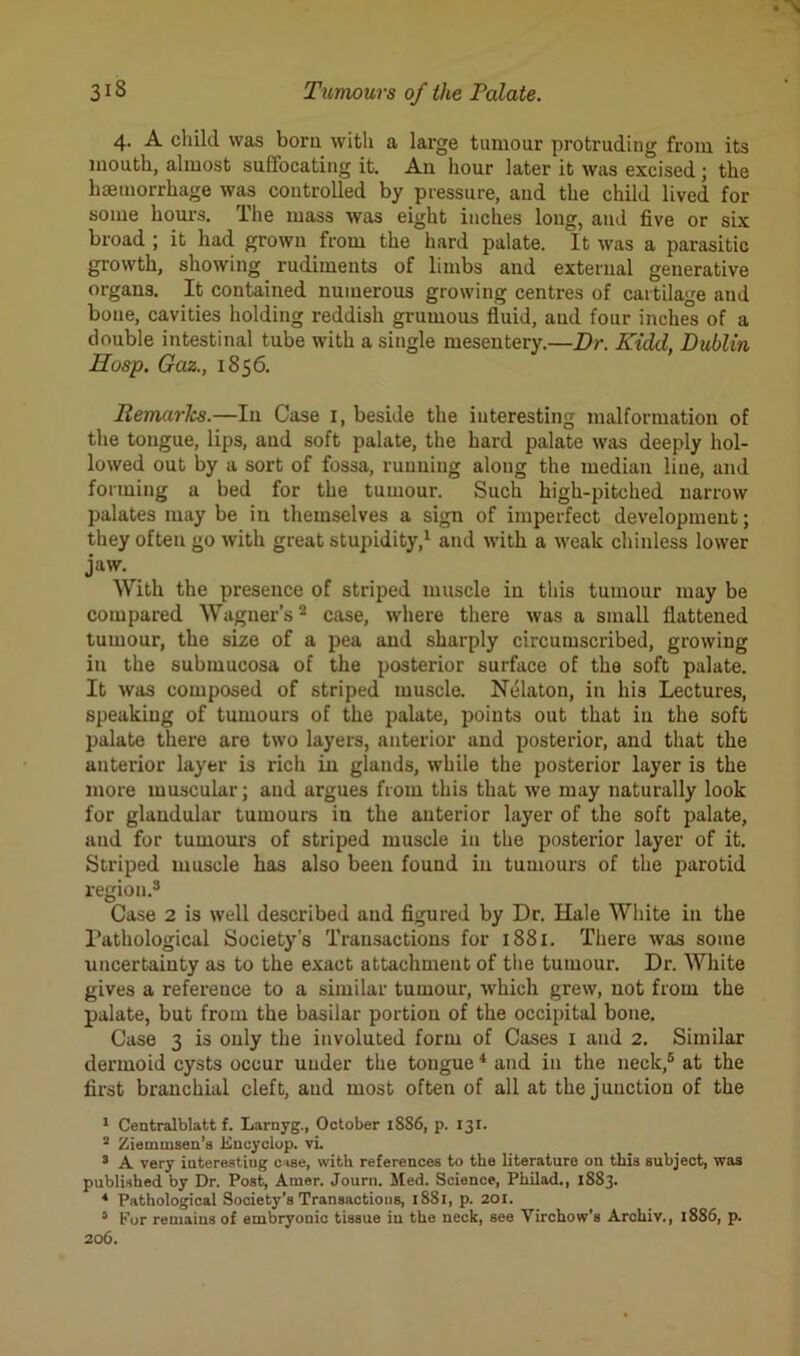 4. A child was bom with a large tumour protruding from its mouth, almost suffocating it. A11 hour later it was excised ; the haemorrhage was controlled by pressure, and the child lived for some hours. The mass was eight inches long, and five or six broad ; it had grown from the hard palate. It was a parasitic growth, showing rudiments of limbs and external generative organs. It contained numerous growing centres of cartilage and bone, cavities holding reddish grumous fluid, and four inches of a double intestinal tube with a single mesentery.—Dr. Kidd, Dublin Hasp. Gaz., 1856. Remarks.—In Case 1, beside the interesting malformation of the tongue, lips, and soft palate, the hard palate was deeply hol- lowed out by a sort of fossa, running along the median line, and forming a bed for the tumour. Such high-pitched narrow palates may be in themselves a sign of imperfect development; they often go with great stupidity,1 and with a weak chinless lower jaw. With the presence of striped muscle in this tumour may be compared Wagner’s2 case, where there was a small flattened tumour, the size of a pea and sharply circumscribed, growing in the submucosa of the posterior surface of the soft palate. It was composed of striped muscle. Nelaton, in his Lectures, speaking of tumours of the palate, points out that in the soft palate there are two layers, anterior and posterior, and that the anterior layer is rich in glands, while the posterior layer is the more muscular; and argues from this that we may naturally look for glandular tumours in the anterior layer of the soft palate, and for tumours of striped muscle in the posterior layer of it. Striped muscle has also been found in tumours of the parotid region.3 Case 2 is well described and figured by Dr. Hale White in the Pathological Society’s Transactions for 1881. There was some uncertainty as to the exact attachment of the tumour. Dr. White gives a reference to a similar tumour, which grew, not from the palate, but from the basilar portion of the occipital bone. Case 3 is only the involuted form of Cases 1 and 2. Similar dermoid cysts occur under the tongue4 and in the neck,5 at the first branchial cleft, and most often of all at the junction of the 1 Centralblatt f. Larnyg., October 1886, p. 131. 2 Ziemmsen’s Kncyclop. vL 3 A very interesting case, with references to the literature on this subject, was published by Dr. Post, Amer. Journ. Med. Science, Pkilad., 1883. 4 Pathological Society's Transactions, 1881, p. 201. 5 For remains of embryonic tissue in the neck, see Virchow’s Arckiv., 1886, p. 206.