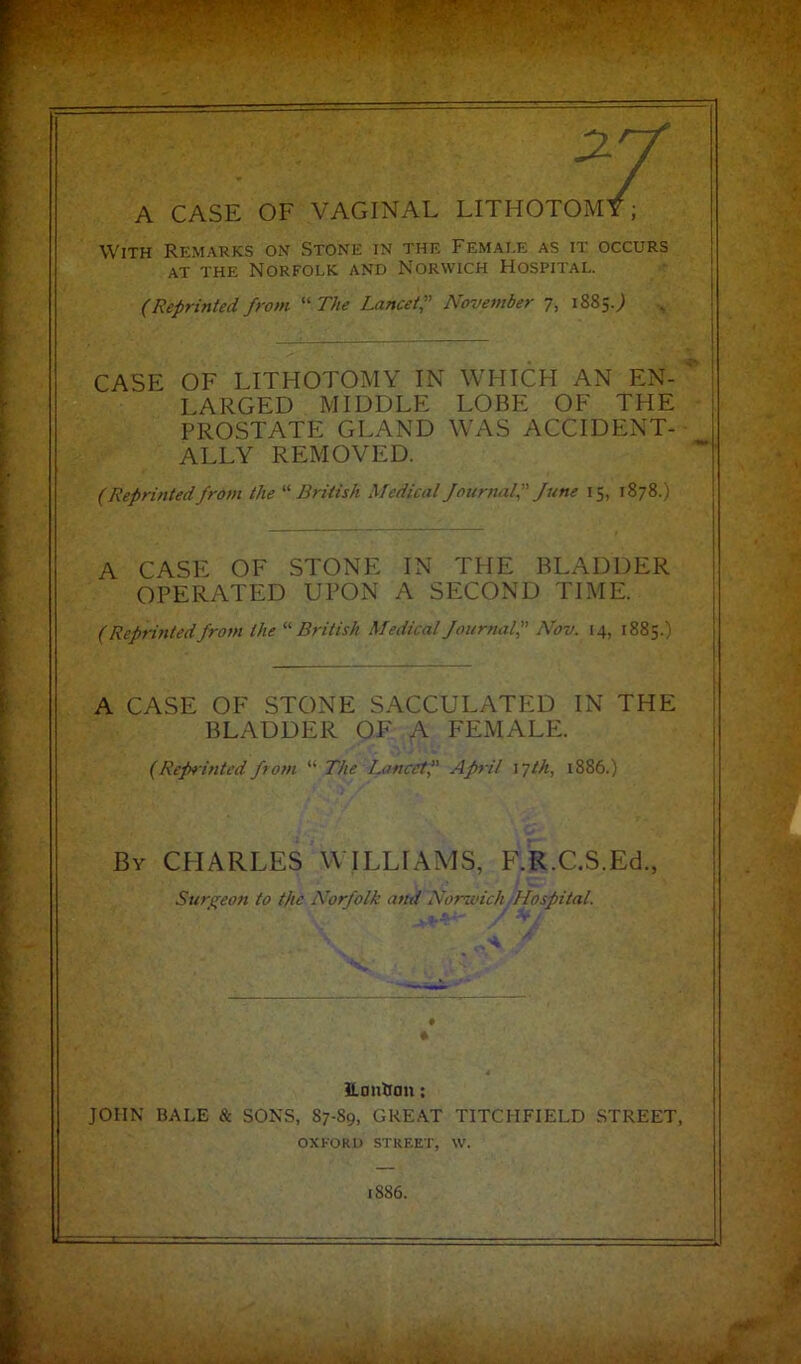 With Remarks on Stone in the Female as it occurs at the Norfolk and Norwich Hospital. (Reprinted from “ The Lancet? November 7, 1885J CASE OF LITHOTOMY IN WHICH AN EN- LARGED MIDDLE LOBE OF THE j PROSTATE GLAND WAS ACCIDENT- ALLY REMOVED. (Reprinted from the '■'■British Medical Journal?- June 15, 1878.) A CASE OF STONE IN THE BLADDER OPERATED UPON A SECOND TIME. (Reprinted from the “British Medical Journal? Nov. 14, 1885.) A CASE OF STONE SACCULATED IN THE BLADDER OF A FEMALE. (Reprinted from “ The Lancet? April 17th, 1886.) By CHARLES WILLIAMS, F.R.C.S.Ed., Surgeon to the Norfolk and Norwich Hospital. ILan&on: JOHN BALE & SONS, 87-89, GREAT TITCHFIELD STREET, OXFORD STREET, W. 886.