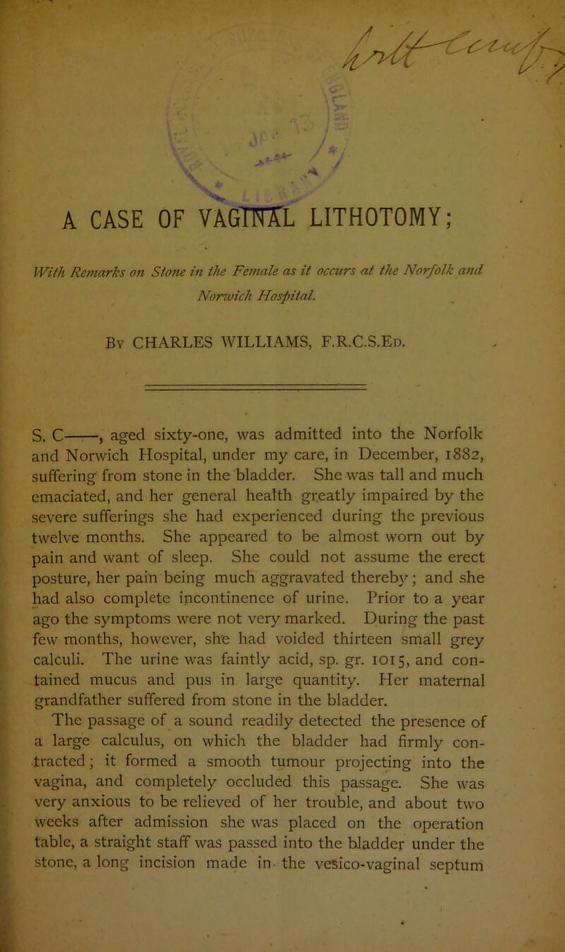 With Remarks on Stone in the Female as it occurs at the Norfolk and Norwich Hospital. By CHARLES WILLIAMS, F.R.C.S.Ed. S. C , aged sixty-onc, was admitted into the Norfolk and Norwich Hospital, under my care, in December, 1882, suffering from stone in the bladder. She was tall and much emaciated, and her general health greatly impaired by the severe sufferings she had experienced during the previous twelve months. She appeared to be almost worn out by pain and want of sleep. She could not assume the erect posture, her pain being much aggravated thereby; and she had also complete incontinence of urine. Prior to a year ago the symptoms were not very marked. During the past few months, however, she had voided thirteen small grey calculi. The urine was faintly acid, sp. gr. 1015, and con- tained mucus and pus in large quantity. Her maternal grandfather suffered from stone in the bladder. The passage of a sound readily detected the presence of a large calculus, on which the bladder had firmly con- tracted ; it formed a smooth tumour projecting into the vagina, and completely occluded this passage. She was very anxious to be relieved of her trouble, and about two weeks after admission she was placed on the operation table, a straight staff was passed into the bladder under the stone, a long incision made in- the vesico-vaginal septum