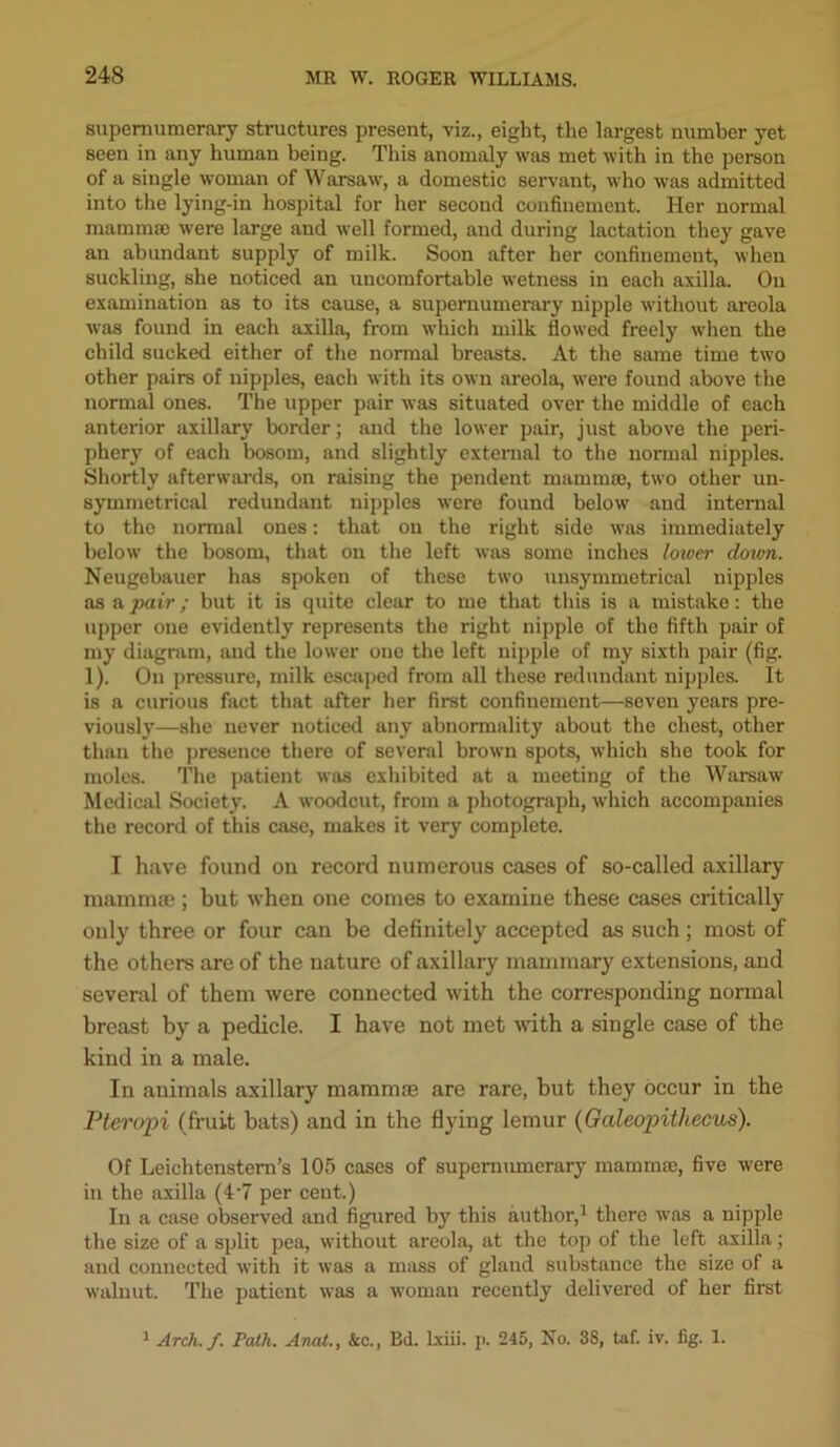 supernumerary structures present, viz., eight, the largest number yet seen in any human being. This anomaly was met with in the person of a single woman of Warsaw, a domestic servant, who was admitted into the lying-in hospital for her second confinement. Her normal mammae were large and well formed, and during lactation they gave an abundant supply of milk. Soon after her confinement, when suckling, she noticed an uncomfortable wetness in each axilla. On examination as to its cause, a supernumerary nipple without areola was found in each axilla, from which milk flowed freely when the child sucked either of the normal breasts. At the same time two other pairs of nipples, each with its own areola, were found above the normal ones. The upper pair was situated over the middle of each anterior axillary border; and the lower pair, just above the peri- phery of each bosom, and slightly external to the normal nipples. Shortly afterwards, on raising the pendent mammae, two other un- symmetrical redundant nipples were found below and internal to the normal ones: that on the right side was immediately below the bosom, that on the left was some inches lower doum. Neugebauer has spoken of these two unsymmetrical nipples as a pair; but it is quite clear to me that this is a mistake: the upper one evidently represents the right nipple of the fifth pair of my diagram, and the lower one the left nipple of my sixth pair (fig. 1). On pressure, milk escaped from all these redundant nipples. It is a curious fact that after her first confinement—seven years pre- viously—she never noticed any abnormality about the chest, other than the presence there of several brown spots, which she took for moles. The patient was exhibited at a meeting of the Warsaw Medical Society. A woodcut, from a photograph, which accompanies the record of this case, makes it very complete. I have found on record numerous cases of so-called axillary mammae; but when one comes to examine these cases critically only three or four can be definitely accepted as such; most of the others are of the nature of axillary mammary extensions, and several of them were connected with the corresponding normal breast by a pedicle. I have not met with a single case of the kind in a male. In animals axillary mammae are rare, but they occur in the Pteropi (fruit bats) and in the flying lemur (Galeopitliecus). Of Leiclitenstem’s 105 cases of supernumerary mammae, five were in the axilla (4-7 per cent.) In a case observed and figured bjr this author,1 there was a nipple the size of a split pea, without areola, at the top of the left axilla; and connected with it was a mass of gland substance the size of a walnut. The patient was a womau recently delivered of her first 1 Arch. f. Path. Anal., kc., Bd. lxiii. p. 245, No. 38, taf. iv. fig. 1.