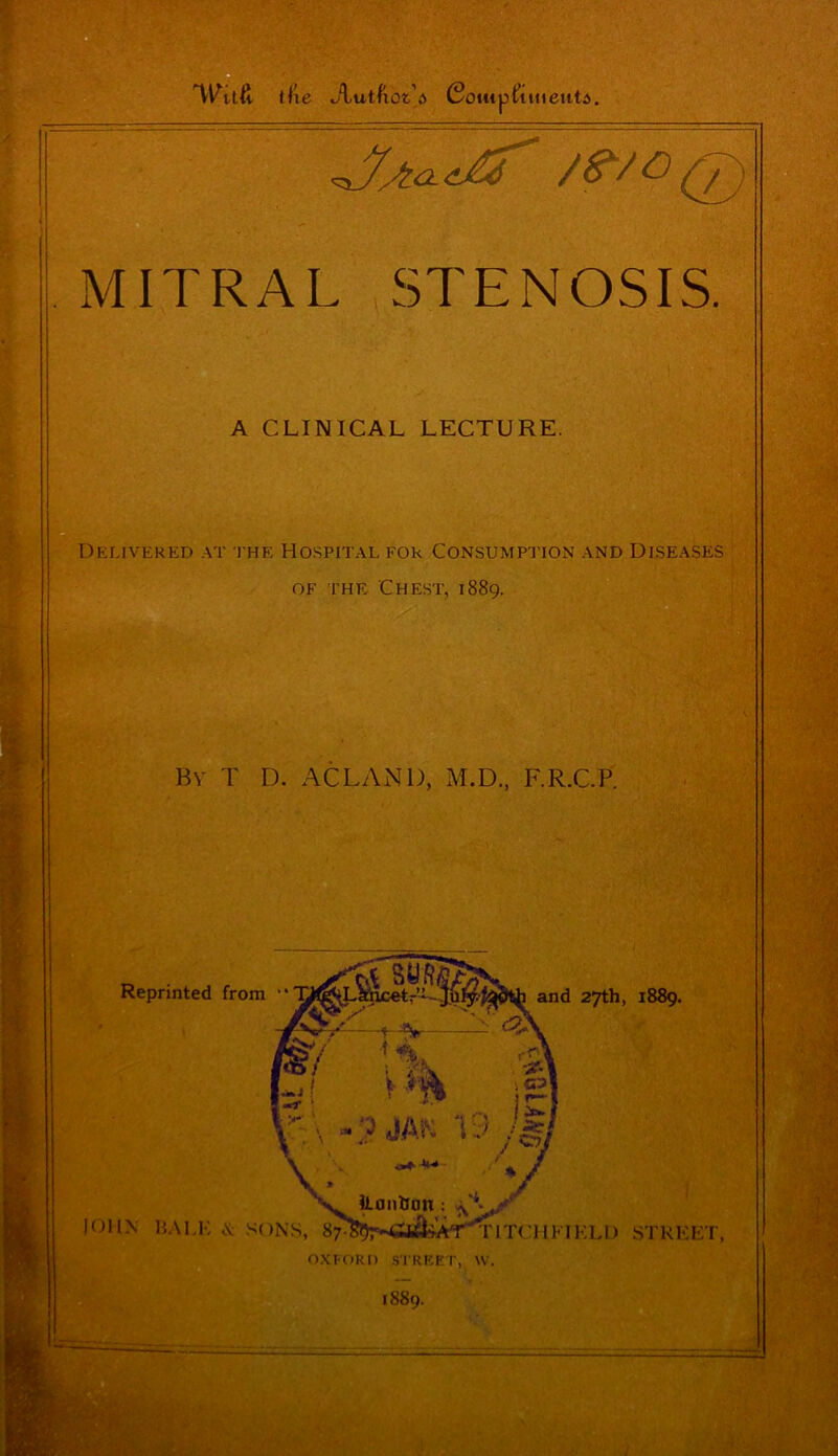 Wild tile Jlutfiot’s Comp&menta. /m® MITRAL STENOSIS. A CLINICAL LECTURE. Delivered at the Hospital for Consumption and Diseases of the Chest, 1889. Bv T D. ACLAN1), M.D., F.R.C.P. 1889.