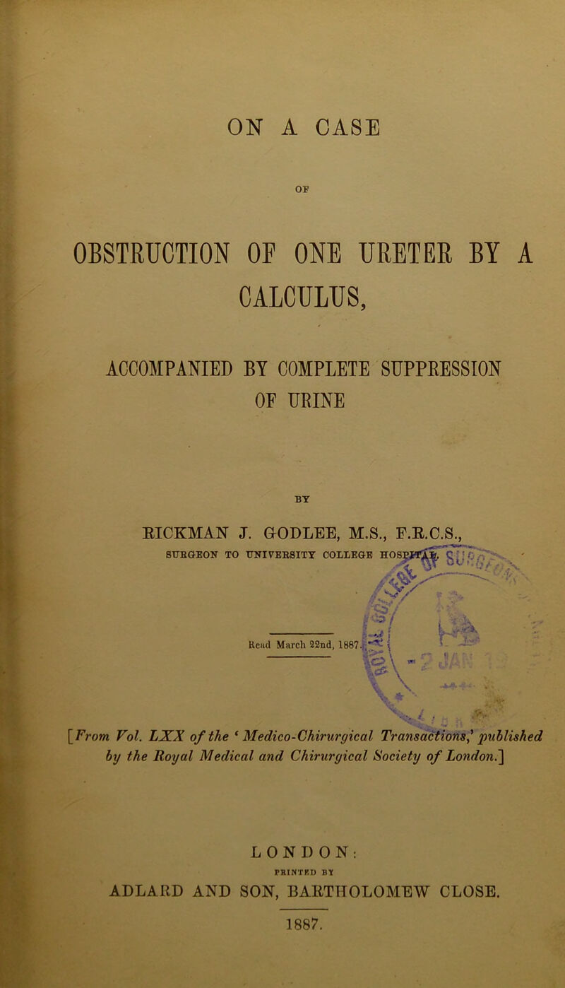 ON A CASE OF OBSTRUCTION OF ONE URETER BY A CALCULUS, ACCOMPANIED BY COMPLETE SUPPRESSION OF URINE EICKMAN J. GrODLEE, M.S., F.R.C.S., SUBGEON TO T7NIVEBSITY COLLEGE HOSEJfT^. ’ s4* A' * ■ • A'*, ■ £y/ ‘'CSV I -3 W r / Head March 22nd, 1887. ( 4>t' viO ! . .V ?:*, P'Jb [From Fo£. LXX of the ‘ Medico-Chirurgiccil Transactions' published by the Royal Medical and Chirurgical Society of London.] LONDON: PRINTED BY ADLARD AND SON, BARTHOLOMEW CLOSE. 1887.