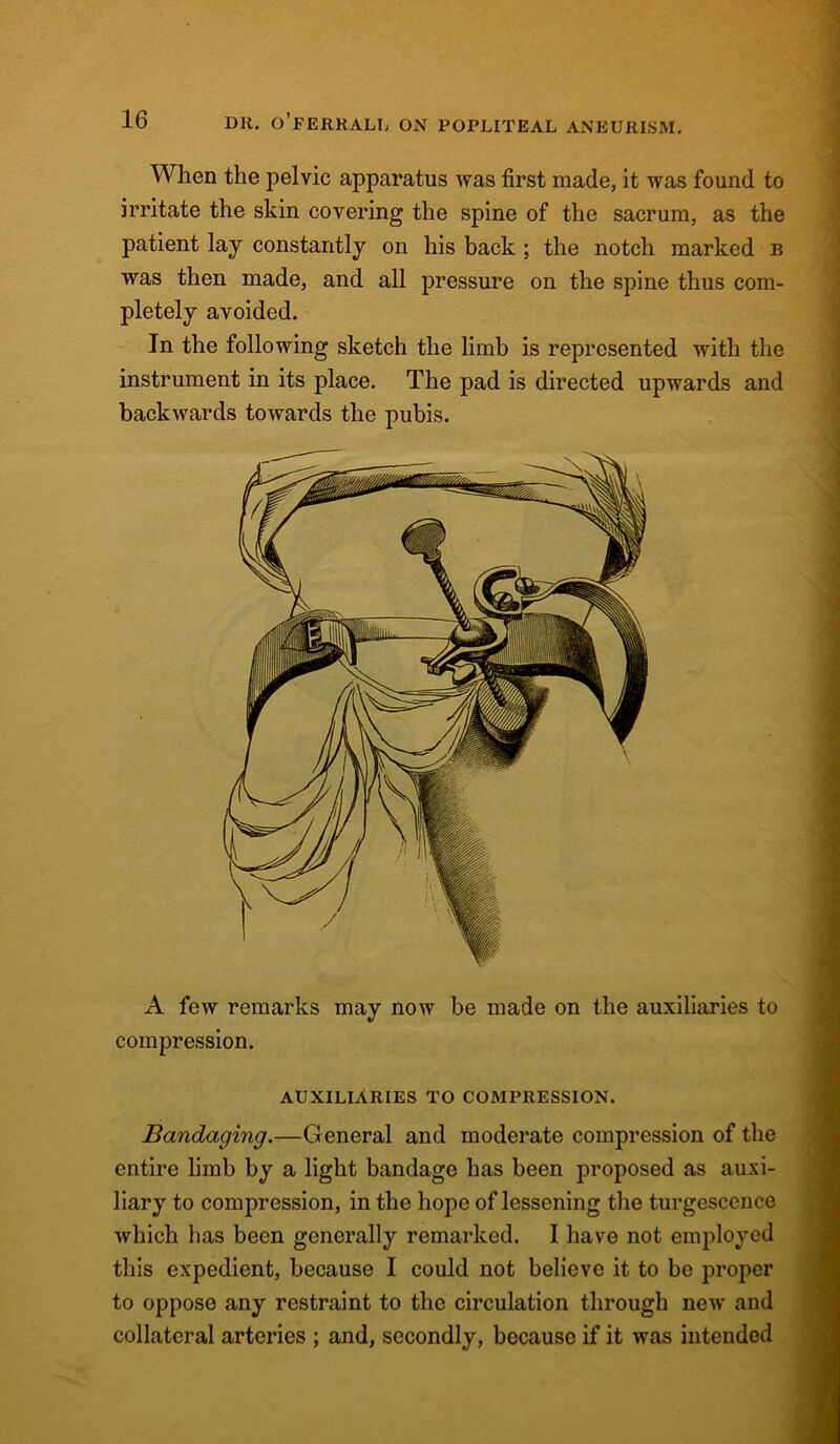 When the pelvic apparatus was first made, it was found to irritate the skin covering the spine of the sacrum, as the patient lay constantly on his back ; the notch marked b was then made, and all pressure on the spine thus com- pletely avoided. In the following sketch the limb is represented with the instrument in its place. The pad is directed upwards and backwards towards the pubis. A few remarks may now be made on the auxiliaries to compression. auxiliaries to compression. Bandaging.—General and moderate compression of the entire limb by a light bandage has been proposed as auxi- liary to compression, in the hope of lessening the turgescence which has been generally remarked. I have not employed this expedient, because I could not believe it to be proper to oppose any restraint to the circulation through new and collateral arteries ; and, secondly, becauso if it was intended