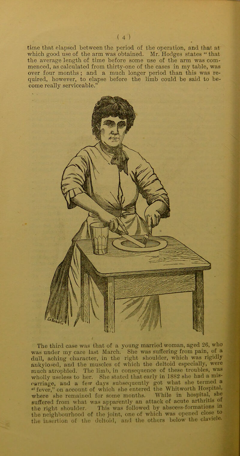 time that elapsed between the period of the operation, and (hat at which good use of the arm was obtained. Mr. Hodges states “ that the average length of time before some use of the arm was com- menced, as calculated from thirty-one of the cases in my table, was over four months ; and a much longer period than this was re- quired, however, to elapse before the limb could be said to be- come really serviceable.” i The third case was that of a young married woman, aged 26, who was under my care last March. She was suffering from pain, of a dull, aching character, in the right shoulder, which vvas rigidly ankylosed, and the muscles of which the deltoid especially, were much atrophied. The limb, in consequence of these troubles, was wholly useless to her. She stated that early in 1S82 she had a mis- earriage, and a few days subsequcntljr got what she termed a “ fever,” on account of which she entered the Whitworth Hospital, where she remained for some months. While in hospital, she suffered from what was apparently an attack of acute arthritis of the right shoulder. This was followed by abscess-formations m the neighbourhood of the joint, one of which was opened close to the insertion of the deltoid, and the others below the clavicle*