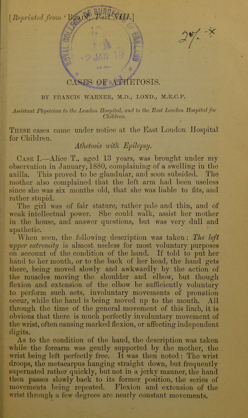 CASES OF ATHETOSIS. BY FRANCIS WARNER, M.D., BOND., M.R.C.P. Assistant Physician to the London Hospital, and to the East London Hospital for Children. These cases came under notice at the East London Hospital for Children. Athetosis with Epilepsy. Case I.—Alice T., aged 13 years, was brought under my observation in January, 1880, complaining of a swelling in the axilla. This proved to be glandular, and soon subsided. The mother also complained that the left arm had been useless since she was six months old, that she was liable to fits, and rather stupid. The girl was of fair stature, rather pale and thin, and of weak intellectual power. She could walk, assist her mother in the house, and answer questions, but was very dull and apathetic. When seen, the following description was taken: The left upper extremity is almost useless for most voluntary purposes on account of the condition of the hand. If told to put her hand to her mouth, or to the back of her head, the hand gets there, being moved slowly and awkwardly by the action of the muscles moving the shoulder and elbow, but though flexion and extension of the elbow be sufficiently voluntary to perform such acts, involuntary movements of pronation occur, while the hand is being moved up to the mouth. All through the time of the general movement of this limb, it is obvious that there is much perfectly involuntary movement of the wrist, often causing marked flexion, or affecting independent digits. As to the condition of the hand, the description was taken while the forearm was gently supported by the mother, tire wrist being left perfectly free. It was then noted: The wrist droops, the metacarpus hanging straight down, but frequently supernated rather quickly, but not in a jerky manner, the hand then passes slowly back to its former position, the series of movements being repeated. Flexion and extension of the wrist through a few degrees are nearly constant movements.