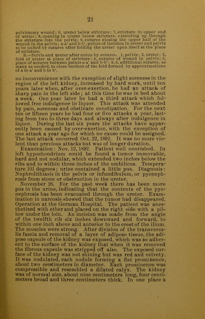 pelviotomy wound; 6, ureter below stricture; 7, stricture in upper end of ureter; 8, opening in ureter below stricture, extending up through the stricture into the pelvis; 9, sutures closing the upper half of the wound in the pelvis; a-a’ and b-b’, points of incision in ureter and pelvis to be united by sutures after folding the ureter upon itself at the place of stricture. B.—Pelvis and ureter after union by sutures. 1, pelvis ; 2, ureter; 3, fold of ureter at place of stricture; 4, sutures of wound in pelvis; 5, place of sutures between points a-a’ and b-b’; 6,6, additional sutures, as many as needed, to close borders of the fold formed by approximations of a to a’ and b to b’. no inconvenience with the exception of slight soreness in the region of the left kidney, increased by hard work, until ten years later when, after over-exertion, he had an attack of sharp pain in the left side; at this time he was in bed about a week. One year later he had a third attack which fol- lowed free indulgence in-liquor. This attack was attended by pain, soreness and obstinate constipation. For the next ten or fifteen years he had four or five attacks a year, last- ing from two to three days and always after indulgence in liquor. During the last six years the attacks have appar- ently been caused by over-exertion, with the exception of one attack a year ago for which no cause could be assigned. The last attack occurred Oct. 22,1892. It was no more vio- lent than previous attacks but was of longer duration. Examination : Nov. 12, 1892. Patient well nourished. In left hypochondrium could be found a tumor immovable, hard and not nodular, which extended two inches below the ribs and to within three inches of the umbilicus. Tempera- ture 101 degrees; urine contained a little pus. Diagnosis: Nephrolithiasis in the pelvis or infundibulum, or pyoneph- rosis from stone or obstruction in the ureter. November 26. For the past week there has been more pus in the urine, indicating that the contents of the pyo- nephrosis has been evacuated through the ureter. Exam- ination in narcosis showed that the tumor had disappeared. Operation at the German Hospital. The patient was anes- thetized with ether and placed on the right sido with a pil- low under the loin. An incision was made from the angle of the twelfth rib six inches downward and forward, to within one inch above and anterior to the crest of the ilium. The muscles were strong. After division of the transversa- ls fascia and removal of a layer of adipose tissue, the adi- pose capsule of the kidney was exposed, which was so adher- ent to the surface of the kidney that when it was removed the fibrous capsule was stripped off also. The exposed sur- face of the kidney was not shining but was red and velvety. It was nodulated, each nodule forming a flat prominence, about two centimeters in diameter. Each prominence was compressible and resembled a dilated calyx. The kidney was of normal size, about nine centimeters long, four centi- meters broad and three centimeters thick. In one place a