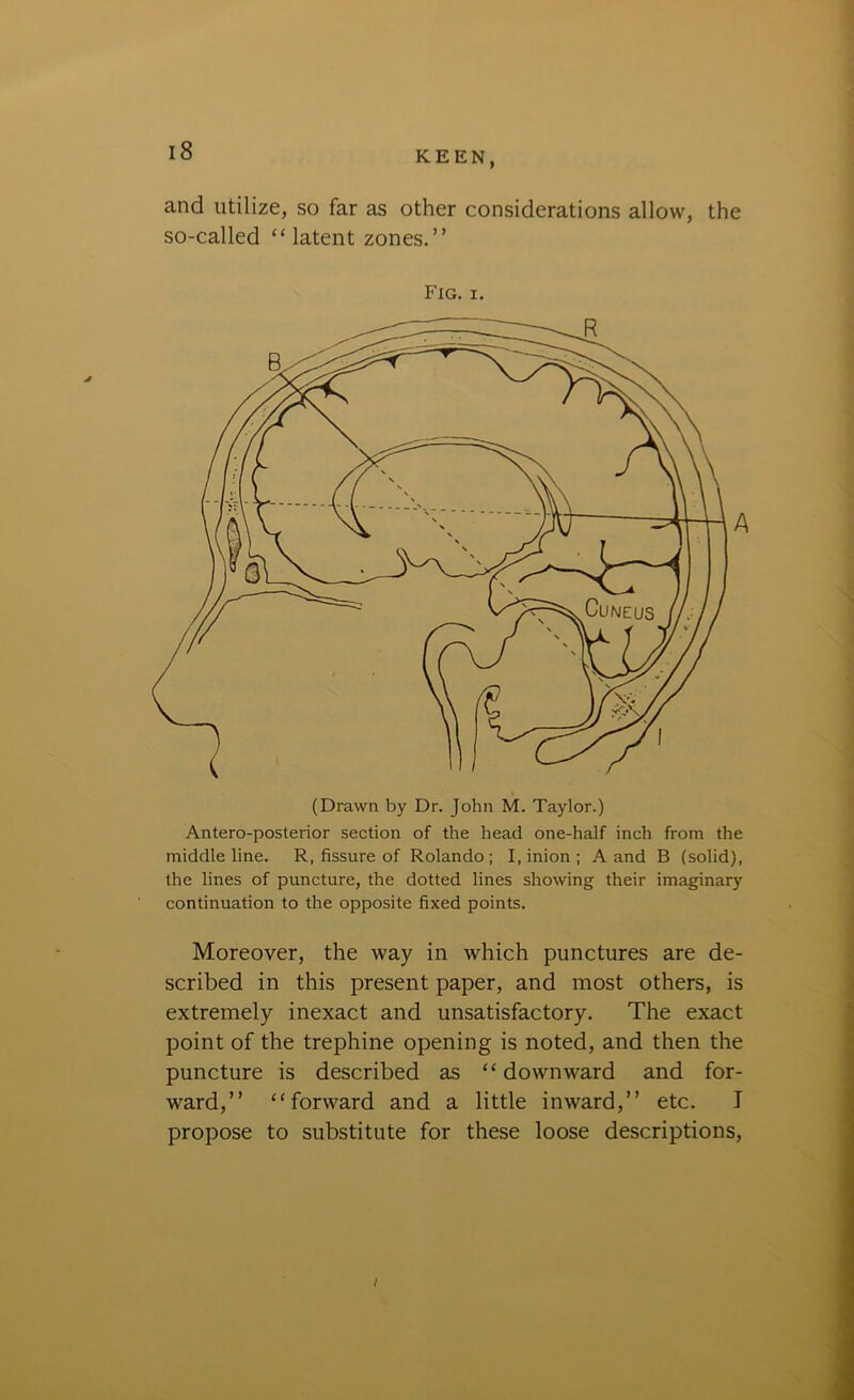 and utilize, so far as other considerations allow, the so-called “latent zones.” Fig. i. (Drawn by Dr. John M. Taylor.) Antero-posterior section of the head one-half inch from the middle line. R, fissure of Rolando; I, inion ; A and B (solid), the lines of puncture, the dotted lines showing their imaginary continuation to the opposite fixed points. Moreover, the way in which punctures are de- scribed in this present paper, and most others, is extremely inexact and unsatisfactory. The exact point of the trephine opening is noted, and then the puncture is described as “ downward and for- ward,” “forward and a little inward,” etc. I propose to substitute for these loose descriptions, i