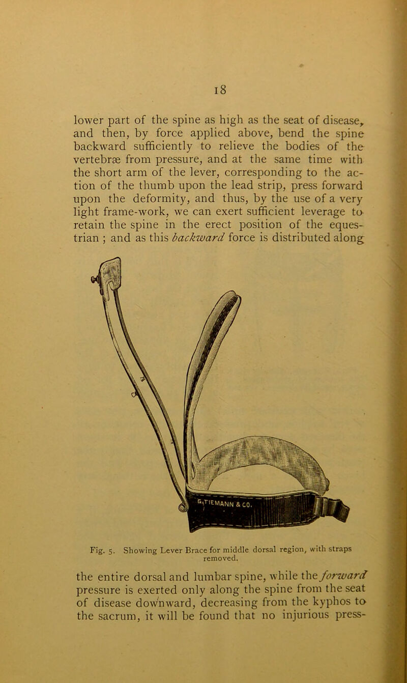lower part of the spine as high as the seat of disease, and then, by force applied above, bend the spine backward sufficiently to relieve the bodies of the vertebrae from pressure, and at the same time with the short arm of the lever, corresponding to the ac- tion of the thumb upon the lead strip, press forward upon the deformity, and thus, by the use of a very light frame-work, we can exert sufficient leverage to retain the spine in the erect position of the eques- trian ; and as this backward force is distributed along the entire dorsal and lumbar spine, while ihe forward pressure is exerted only along the spine from the seat of disease downward, decreasing from the kyphos to the sacrum, it will be found that no injurious press-