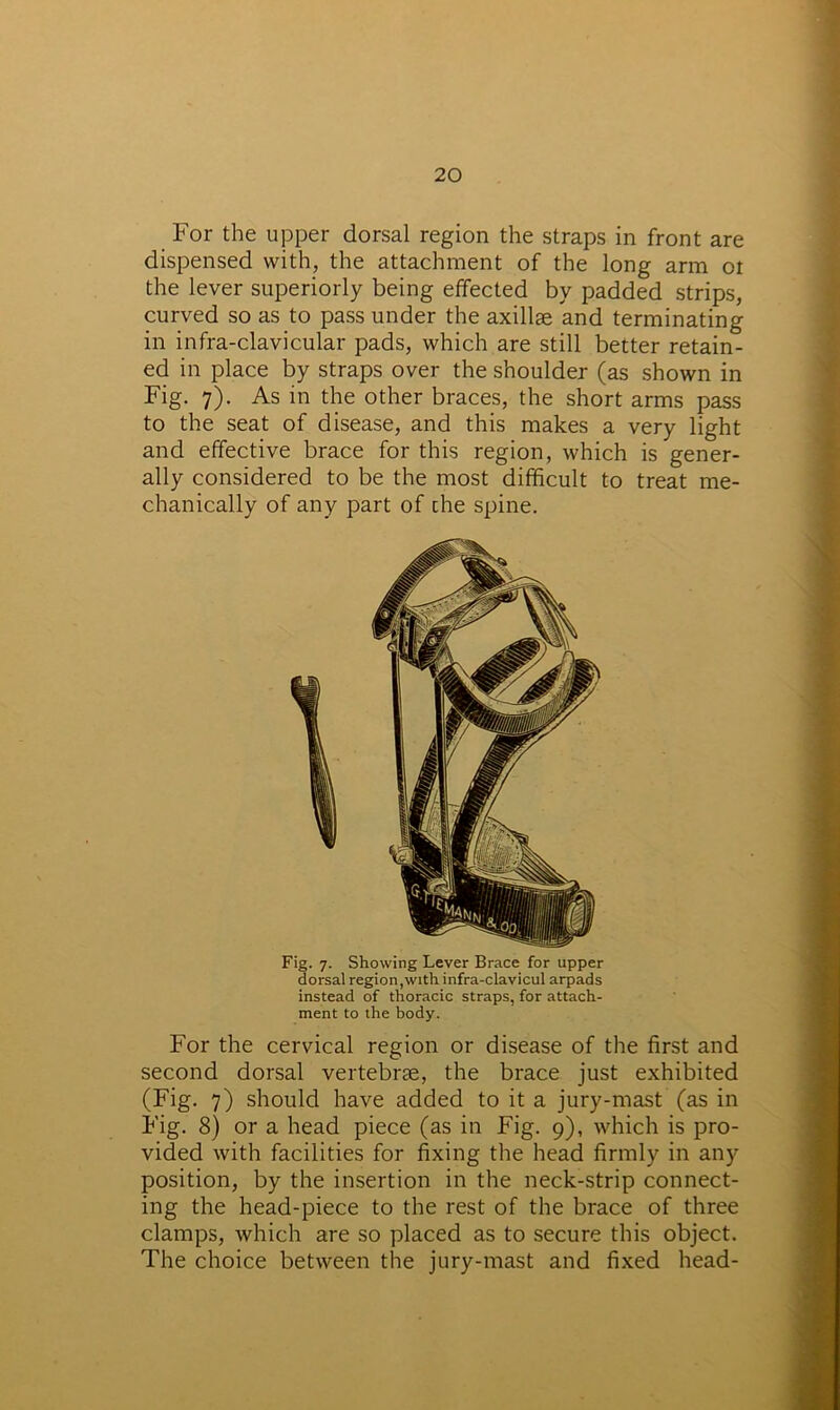 For the upper dorsal region the straps in front are dispensed with, the attachment of the long arm ot the lever superiorly being effected by padded strips, curved so as to pass under the axillae and terminating in infra-clavicular pads, which are still better retain- ed in place by straps over the shoulder (as shown in Fig. 7). As in the other braces, the short arms pass to the seat of disease, and this makes a very light and effective brace for this region, which is gener- ally considered to be the most difficult to treat me- chanically of any part of che spine. Fig. 7. Showing Lever Brace for upper dorsal region,with infra-clavicul arpads instead of thoracic straps, for attach- ment to the body. For the cervical region or disease of the first and second dorsal vertebrae, the brace just exhibited (Fig. 7) should have added to it a jury-mast (as in Fig. 8) or a head piece (as in Fig. 9), which is pro- vided with facilities for fixing the head firmly in any position, by the insertion in the neck-strip connect- ing the head-piece to the rest of the brace of three clamps, which are so placed as to secure this object. The choice between the jury-mast and fixed head-
