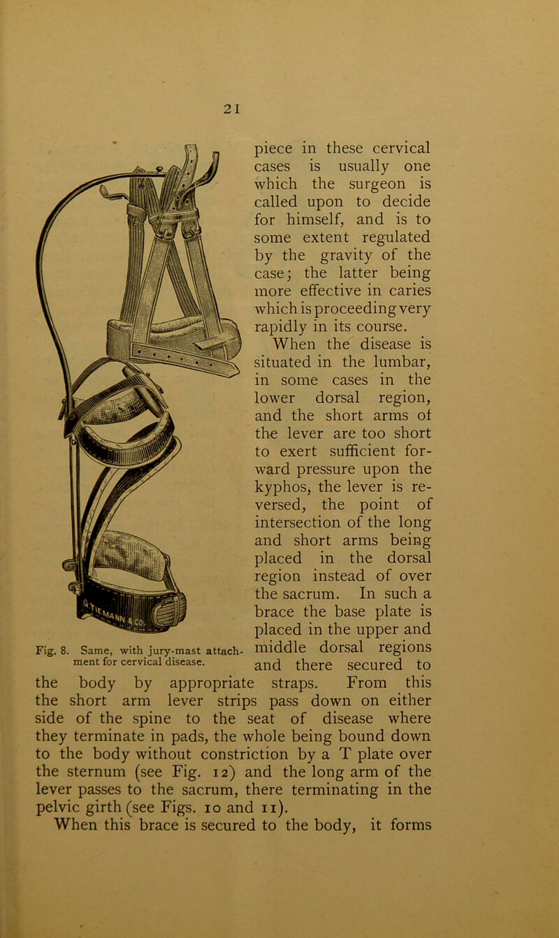 piece in these cervical cases is usually one which the surgeon is called upon to decide for himself, and is to some extent regulated by the gravity of the case; the latter being more effective in caries which is proceeding very rapidly in its course. When the disease is situated in the lumbar, in some cases in the lower dorsal region, and the short arms ot the lever are too short to exert sufficient for- ward pressure upon the kyphos, the lever is re- versed, the point of intersection of the long and short arms being placed in the dorsal region instead of over the sacrum. In such a brace the base plate is placed in the upper and Fig. 8. Same, with jury-mast attach- middle dorsal legions ment for cervical disease. and there Secured to the body by appropriate straps. From this the short arm lever strips pass down on either side of the spine to the seat of disease where they terminate in pads, the whole being bound down to the body without constriction by a T plate over the sternum (see Fig. 12) and the long arm of the lever passes to the sacrum, there terminating in the pelvic girth (see Figs. 10 and 11). When this brace is secured to the body, it forms
