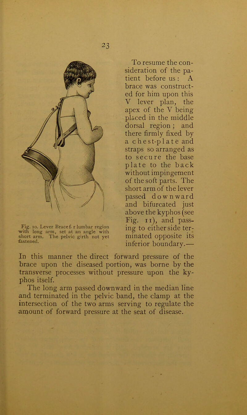 Fig. io. Lever Brace f. r lumbar region with long arm, set at an angle with short arm. The pelvic girth not yet fastened. To resume the con- sideration of the pa- tient before us : A brace was construct- ed for him upon this V lever plan, the apex of the V being placed in the middle dorsal region ; and there firmly fixed by a chest-plate and straps so arranged as to secure the base plate to the back without impingement of the soft parts. The short arm of the lever passed downward and bifurcated just above the kyphos (see Fig. n), and pass- ing to either side ter- minated opposite its inferior boundary.— In this manner the direct forward pressure of the brace upon the diseased portion, was borne by the transverse processes without pressure upon the ky- phos itself. The long arm passed downward in the median line and terminated in the pelvic band, the clamp at the intersection of the two arms serving to regulate the amount of forward pressure at the seat of disease.
