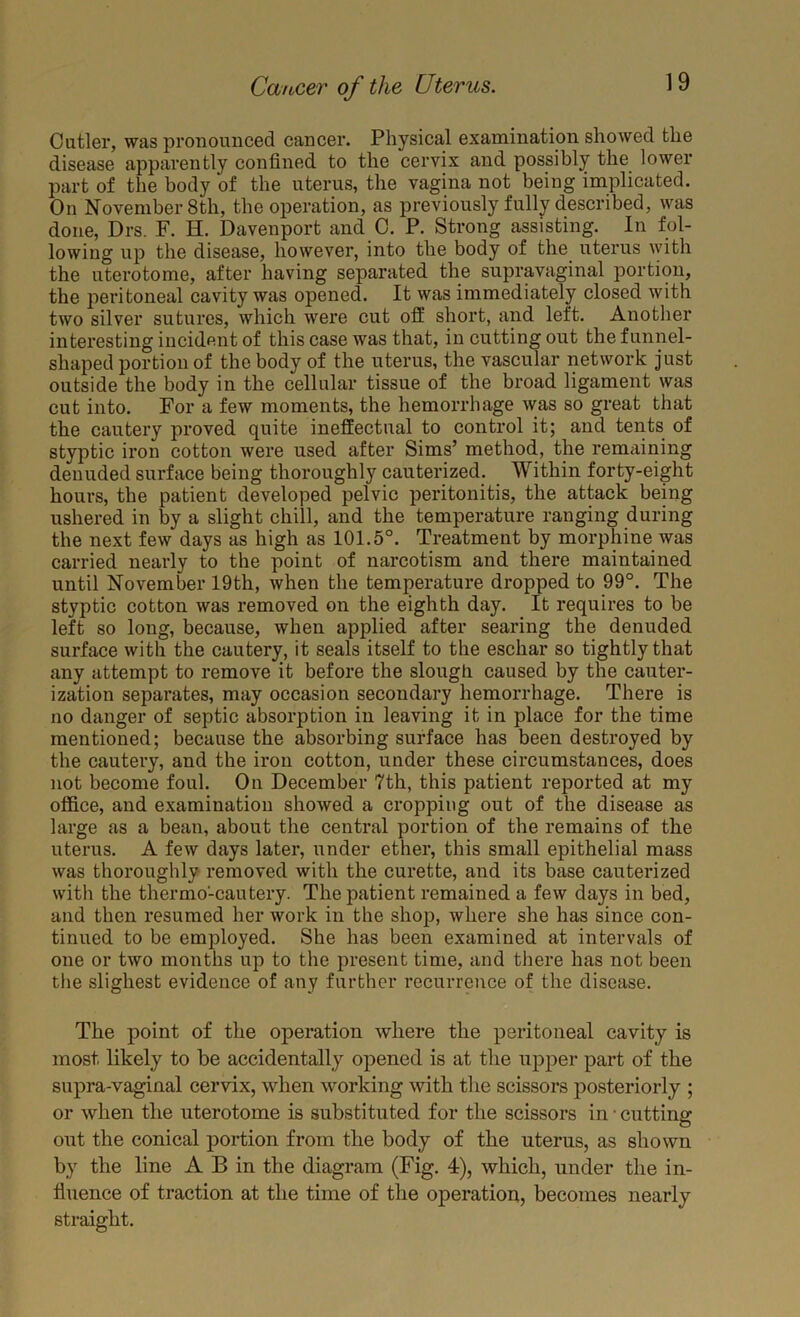 Cutler, was pronounced cancer. Physical examination showed the disease apparently confined to the cervix and possibly the lower part of the body of the uterus, the vagina not being implicated. On November 8th, the operation, as previously fully described, was done, Drs. F. H. Davenport and 0. P. Strong assisting. In fol- lowing up the disease, however, into the body of the uterus with the uterotome, after having separated the suprpaginal portion, the peritoneal cavity was opened. It was immediately closed with two silver sutures, which were cut off short, and left. Another interesting incident of this case was that, in cutting out the funnel- shaped portion of the body of the uterus, the vascular network just outside the body in the cellular tissue of the broad ligament was cut into. For a few moments, the hemorrhage was so great that the cautery proved quite ineffectual to control it; and tents of styptic iron cotton were used after Sims’ method, the rem^iining denuded surface being thoroughly cauterized. Within forty-eight hours, the patient developed pelvic peritonitis, the attack being ushered in by a slight chill, and the temperature ranging during the next few days as high as 101.5°. Treatment by morphine was carried nearly to the point of narcotism and there maintained until November 19th, when the temperature dropped to 99°. The styptic cotton was removed on the eighth day. It requires to be left so long, because, when applied after searing the denuded surface with the cautery, it seals itself to the eschar so tightly that any attempt to remove it before the slough caused by the cauter- ization separates, may occasion secondary hemorrhage. There is no danger of septic absorption in leaving it in place for the time mentioned; because the absorbing surface has been destroyed by the cautery, and the iron cotton, under these circumstances, does not become foul. On December 7th, this patient reported at my office, and examination showed a cropping out of the disease as large as a bean, about the central portion of the remains of the uterus. A few days later, under ether, this small epithelial mass was thoroughly removed with the curette, and its base cauterized with the thermo-cautery. The patient remained a few days in bed, and then resumed her work in the shop, where she has since con- tinued to be employed. She has been examined at intervals of one or two months up to the present time, and there has not been tlie slighest evidence of any further recurrence of the disease. The point of the operation where the peritoneal cavity is most likely to be accidentally opened is at the upper part of the supra-vaginal cervix, when working with the scissors posteriorly ; or when the uterotome is substituted for the scissors in • cutting out the conical portion from the body of the uterus, as shown by the line A B in the diagram (Fig, 4), which, under the in- fluence of traction at the time of the operation, becomes nearly straight.