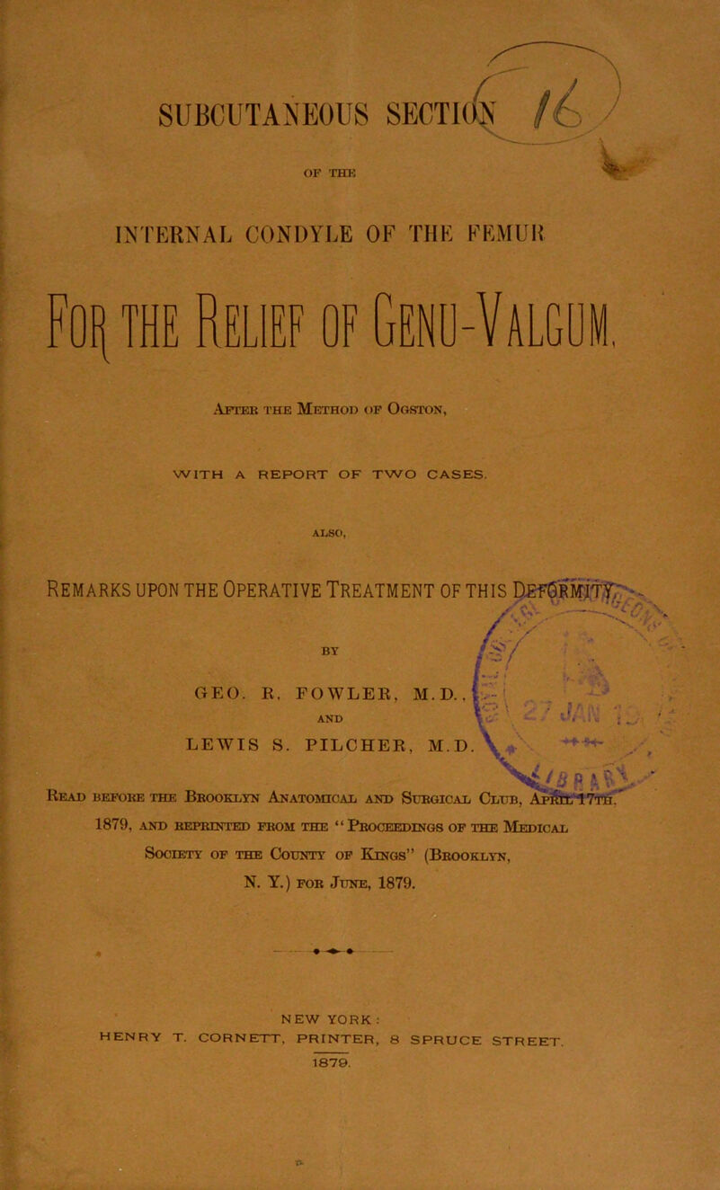 SUBCUTANEOUS SECTK OF THE INTERNAL CONDYLE OF THE FEMUR Relief of Genu-Valgum. After the Method of Ogston, WITH A REPORT OF TWO CASES. ALSO, Remarks upon the Operative Treatment of this Deformity, BY / V r ■ -■ / GEO. R. FOWLER, M. D., f AND . < LEWIS S. PILCHER, M.D.\ Read before the Brooklyn Anatomical and Surgical Club, Apfflx lTTH. 1879, AND REPRINTED FROM THE “PROCEEDINGS OF THE MEDICAL Society of the County of Kings” (Brooklyn, N. Y.) for June, 1879. NEW YORK: HENRY T. CORNETT. PRINTER, 8 SPRUCE STREET 1879.